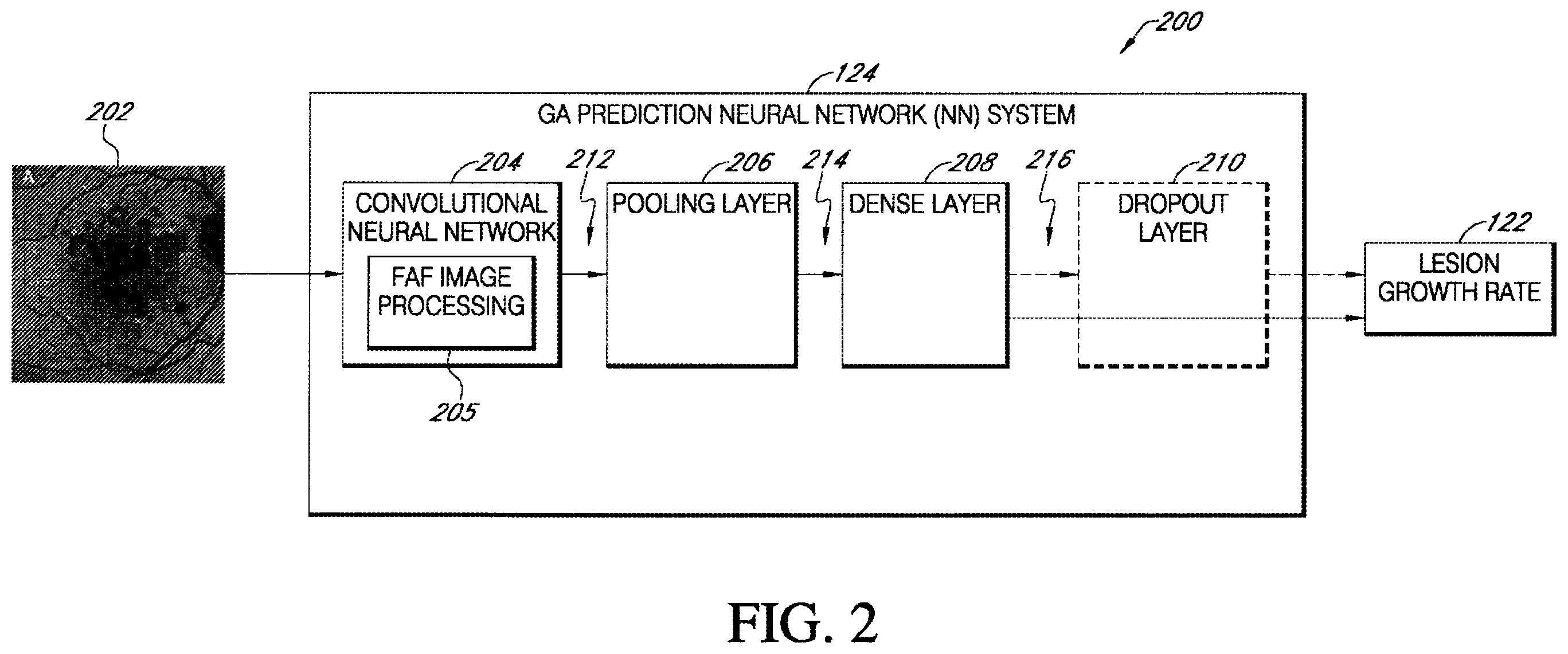 Patent US12367966 Figure 2 – Predicting geographic atrophy growth rate from fundus autofluorescence images using deep neural networks