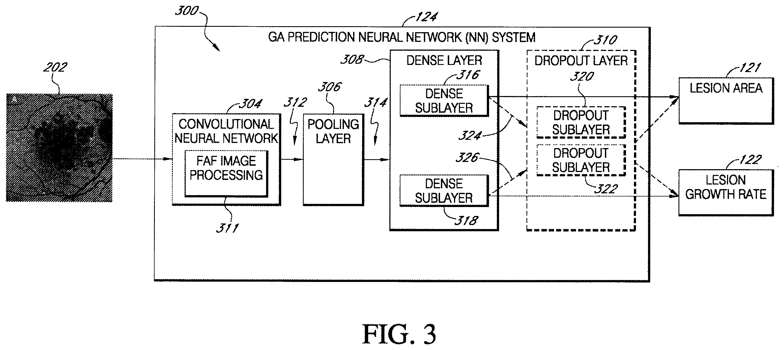 Patent US12367966 Figure 3 – Predicting geographic atrophy growth rate from fundus autofluorescence images using deep neural networks