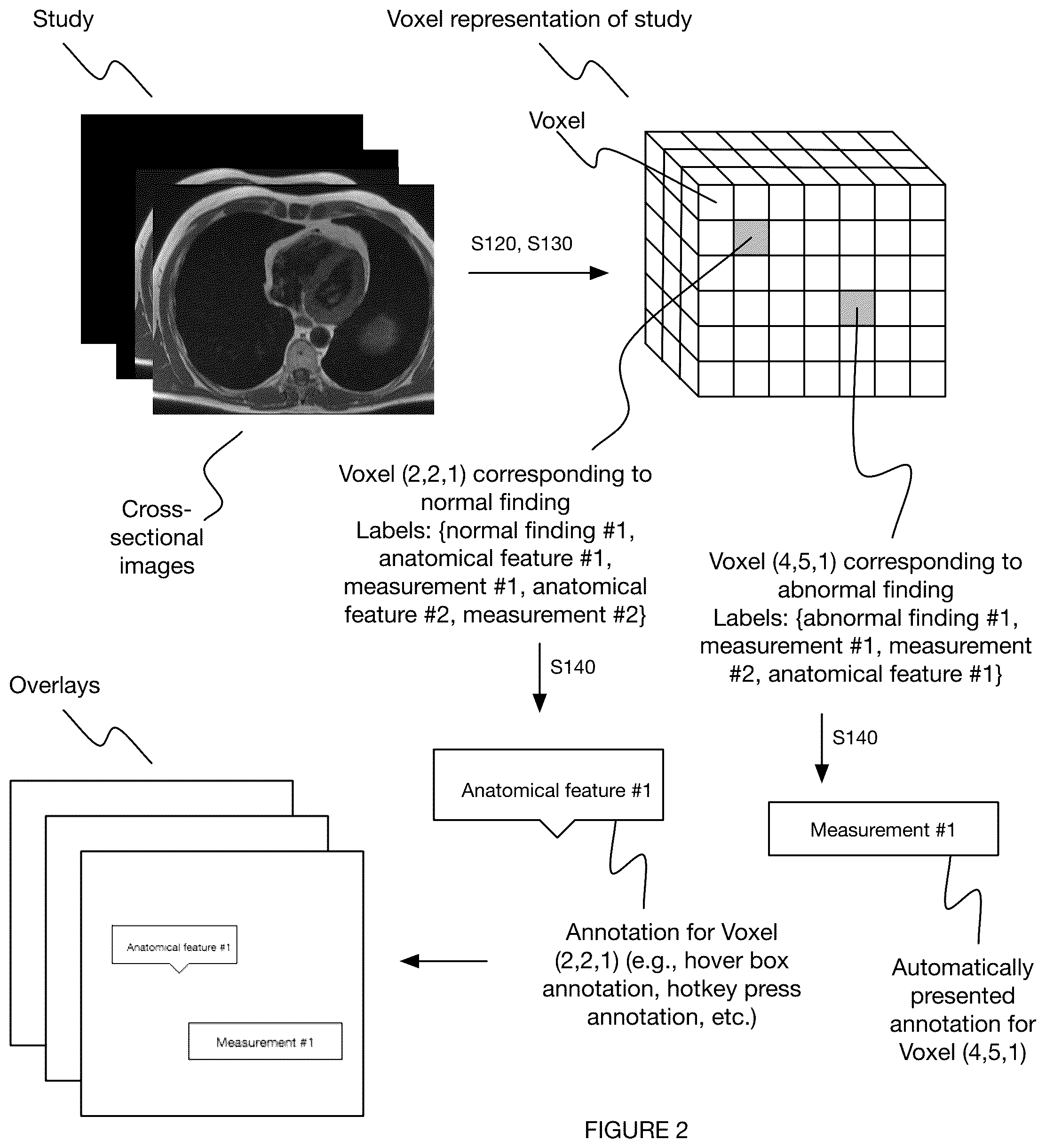 Patent US12367967 Figure 2 – System and method for automated annotation of radiology findings