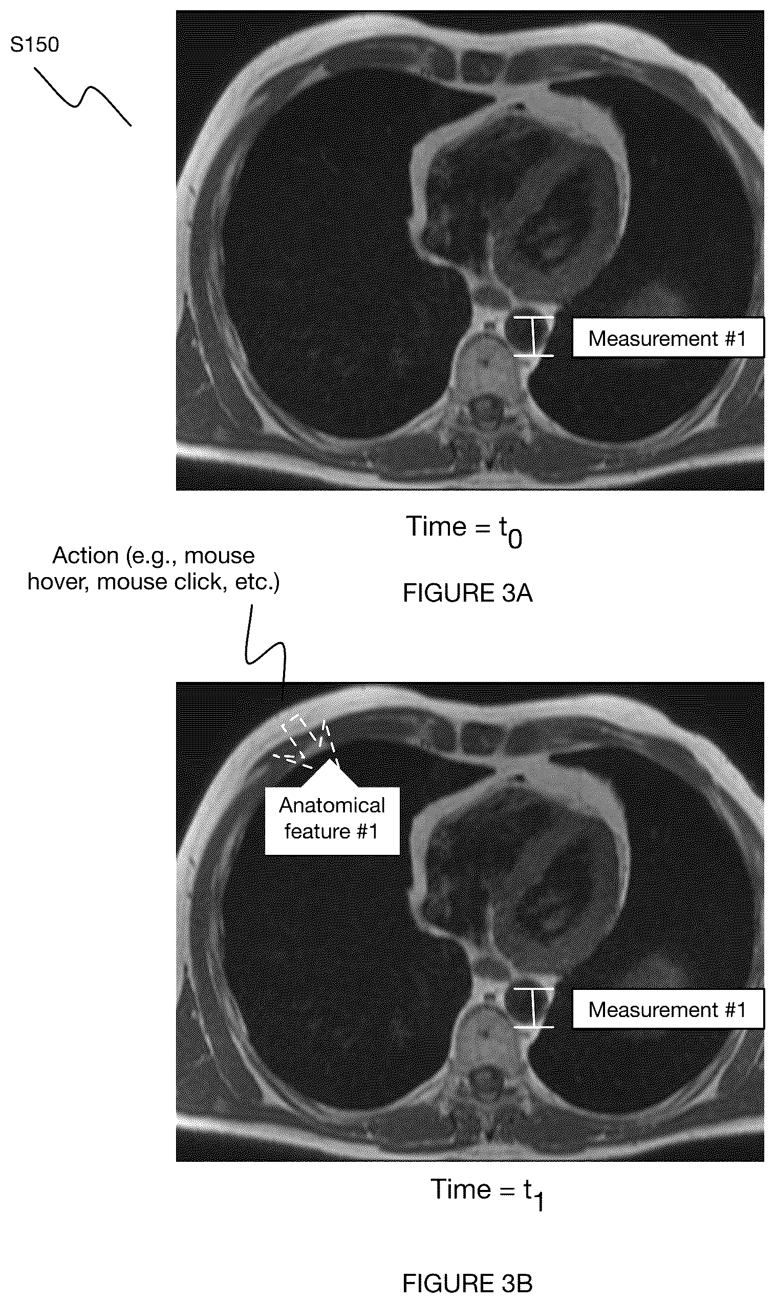Patent US12367967 Figure 3 – System and method for automated annotation of radiology findings