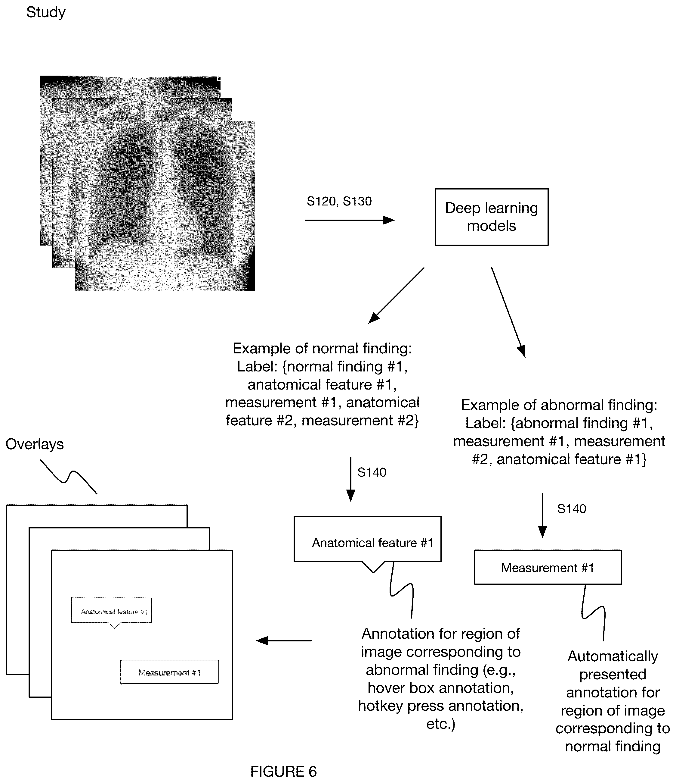 Patent US12367967 Figure 6 – System and method for automated annotation of radiology findings