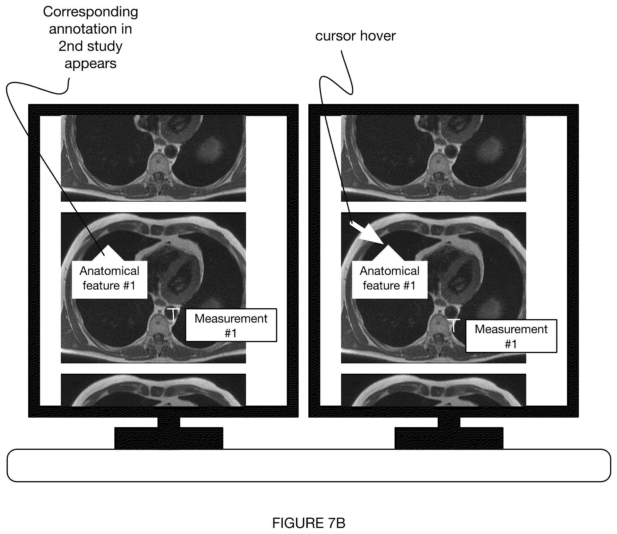 Patent US12367967 Figure 8 – System and method for automated annotation of radiology findings