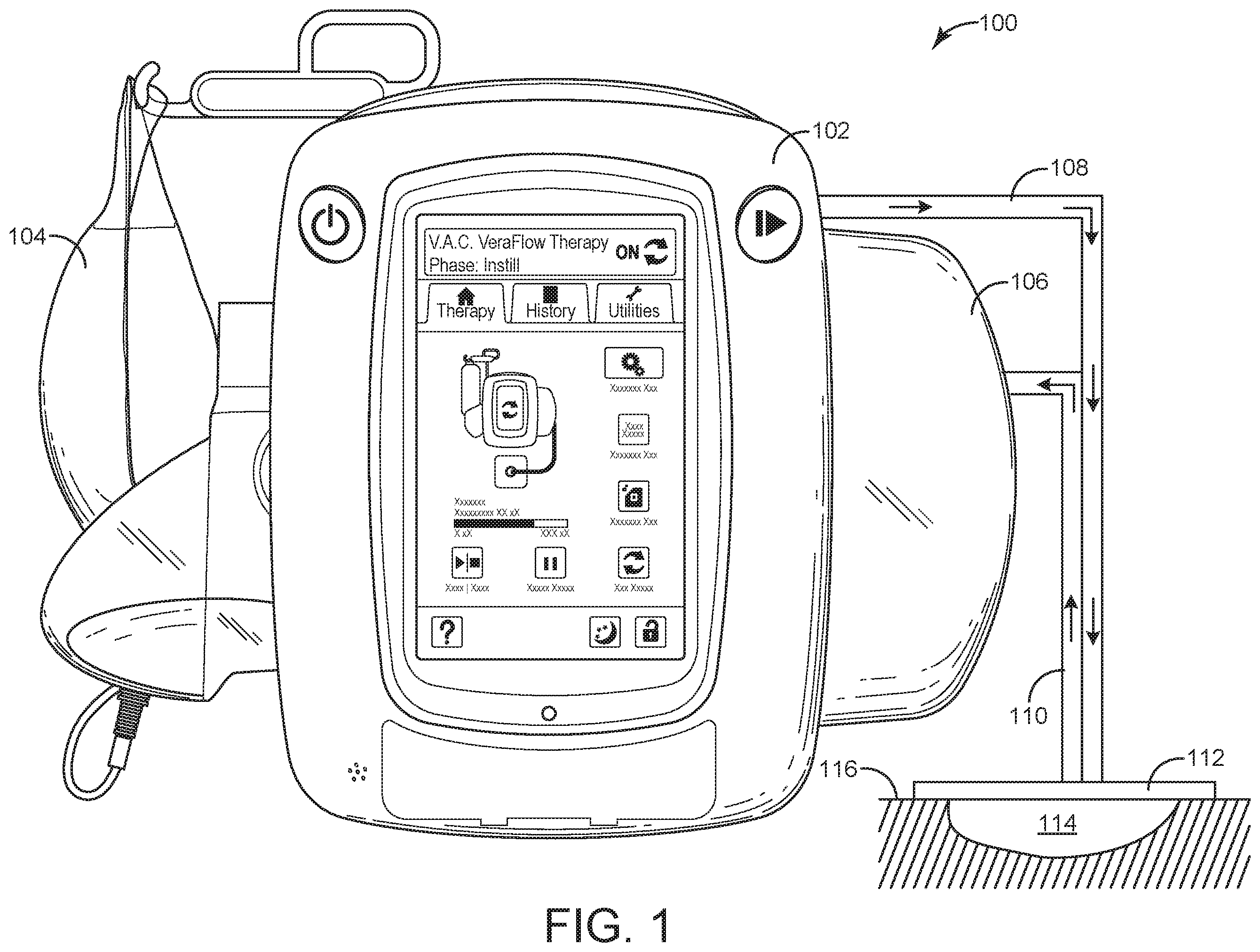Patent US12367974 Figure 1 – Wound therapy system with wound volume estimation