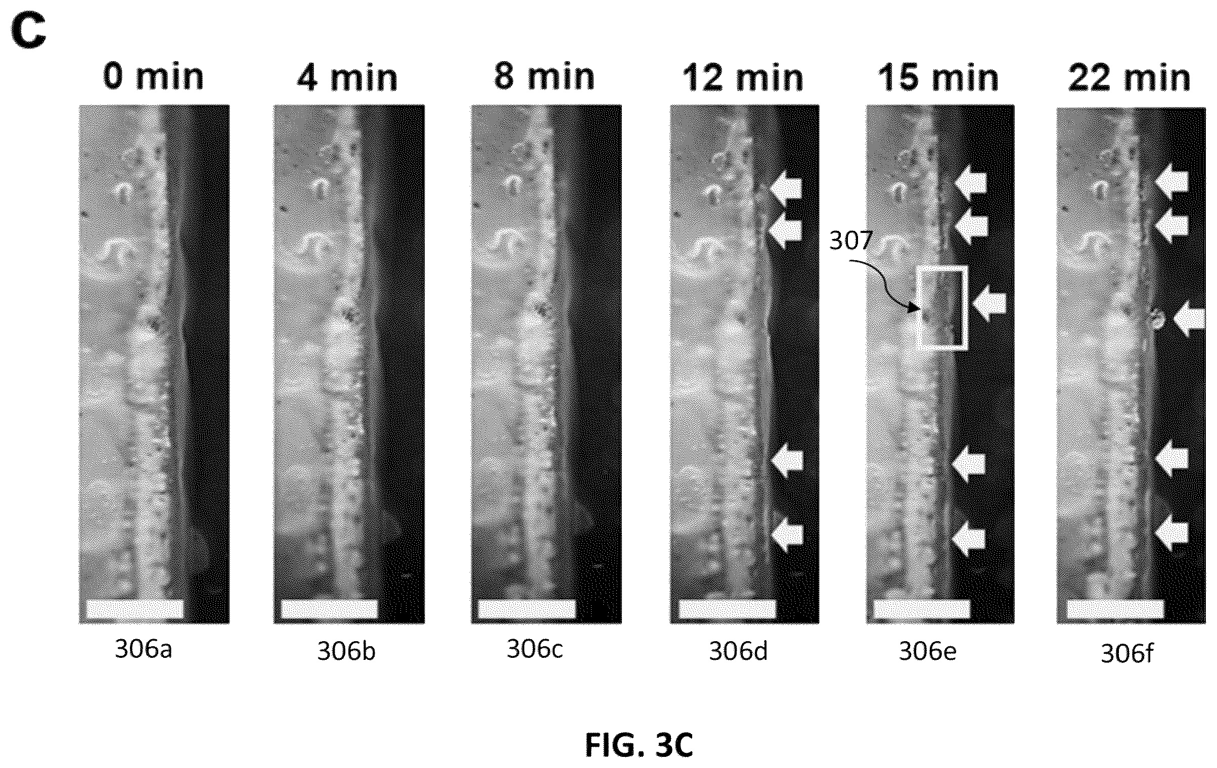 Patent US12368190 Figure 11 – Systems and methods of detecting Li dendrites