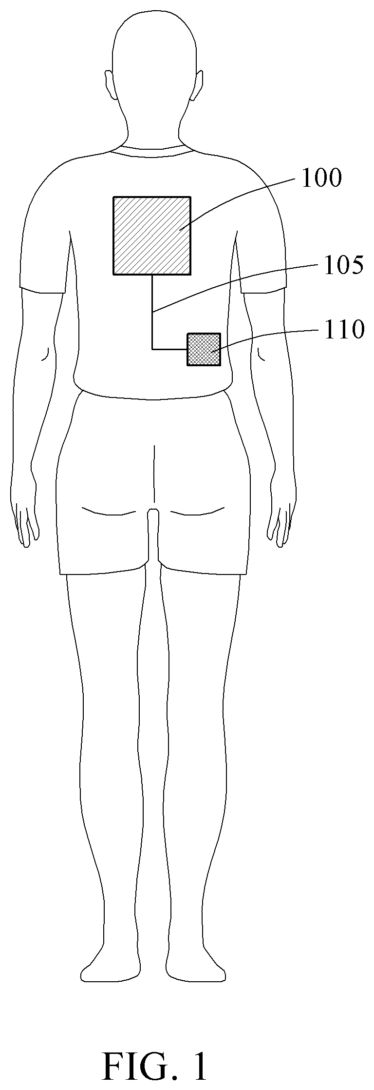 Patent US12368234 Figure 1 – Fibre-based wearable patch antenna