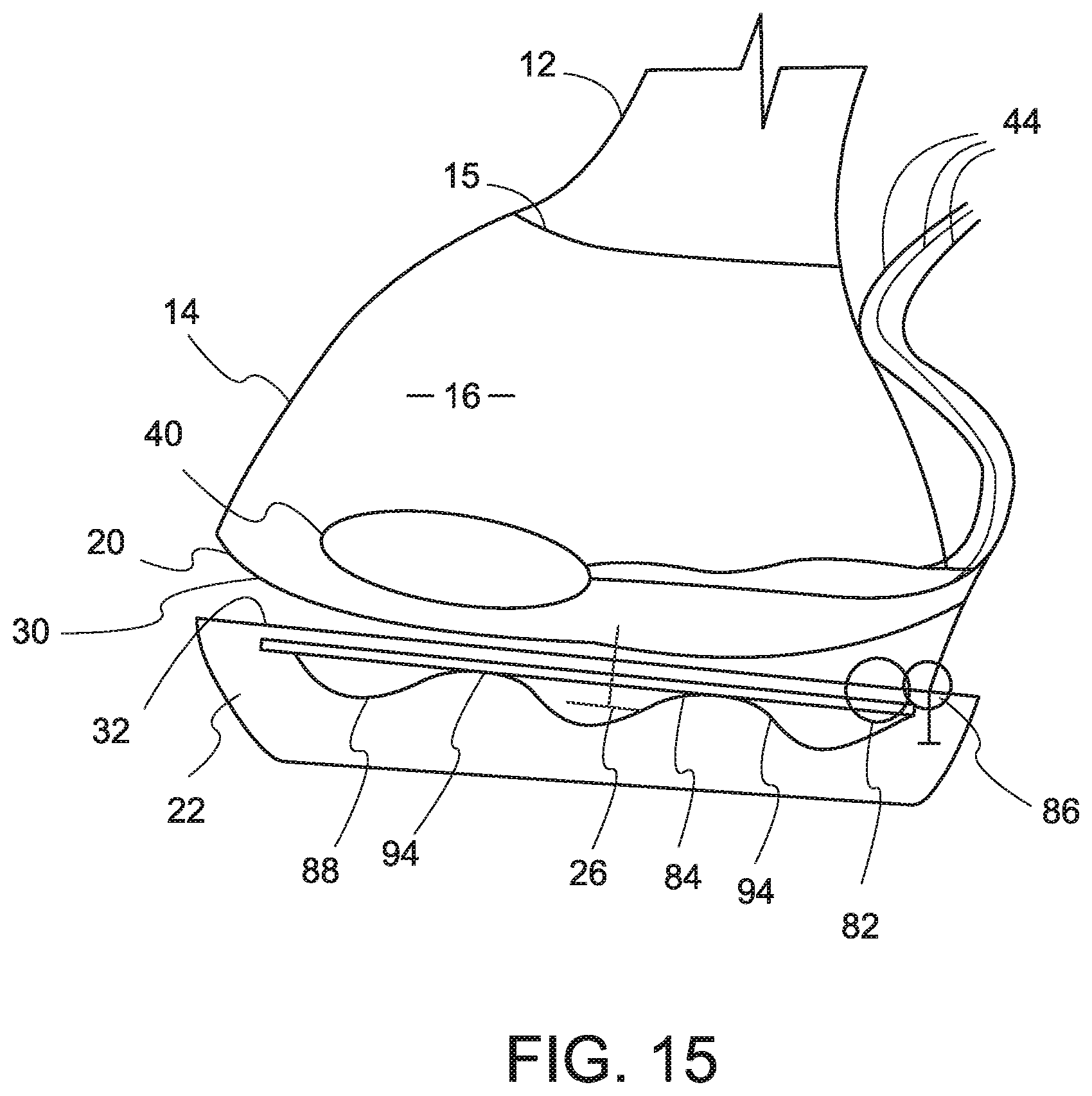 Patent US12376565 Figure 10 – Equine biomechanical orthotic device and method of use