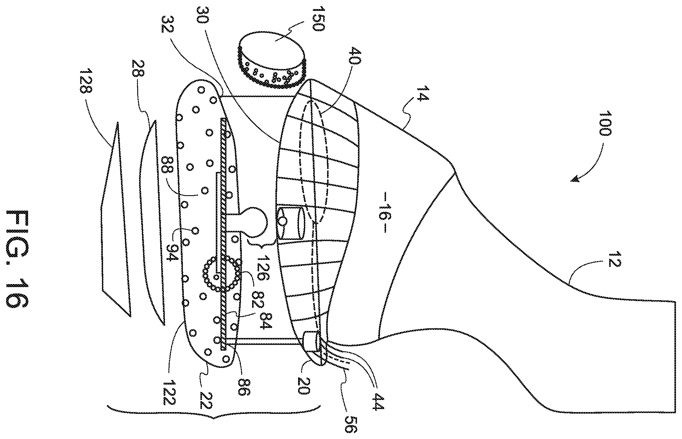 Patent US12376565 Figure 11 – Equine biomechanical orthotic device and method of use