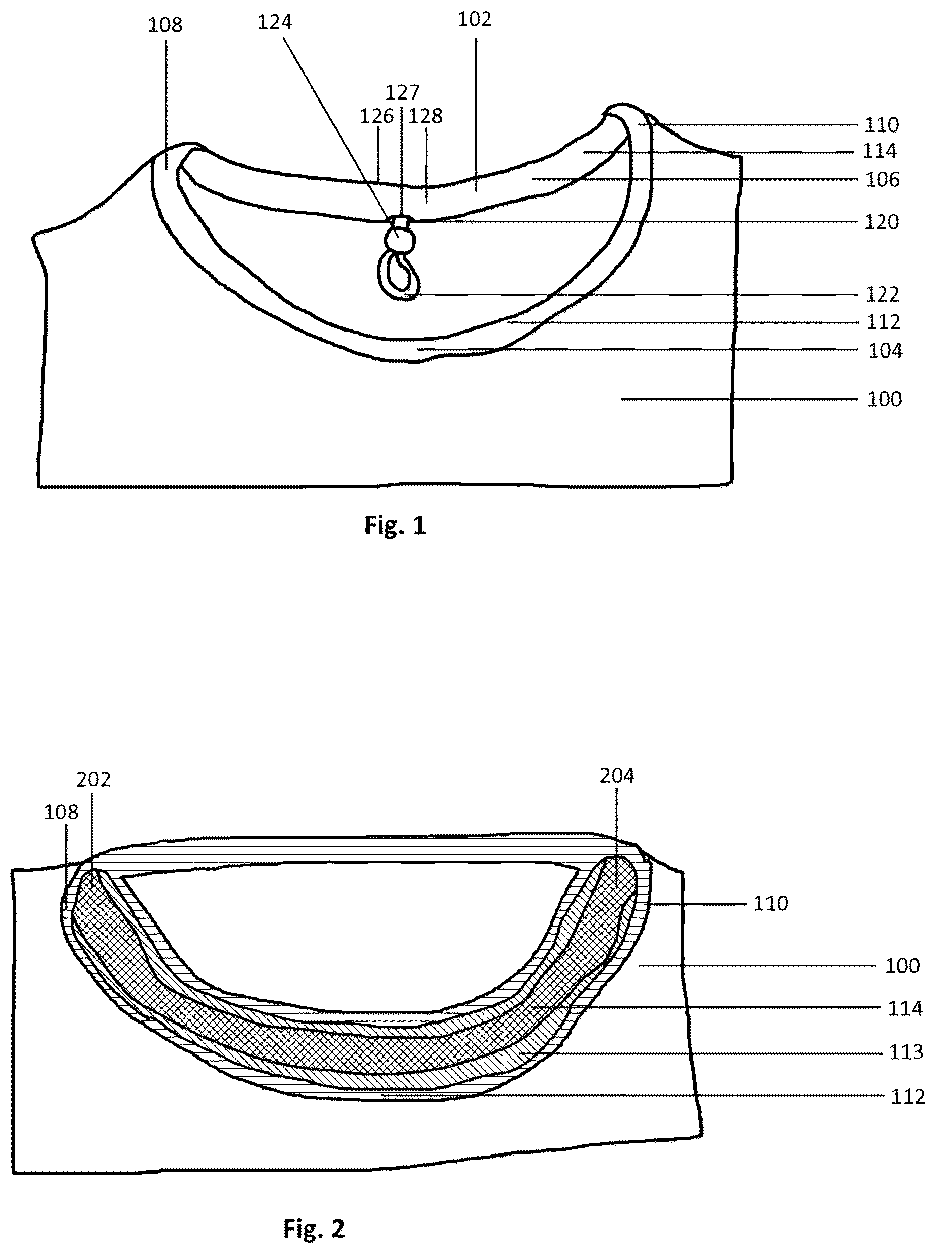 Patent US12376627 Figure 1 – Neckline fitting system