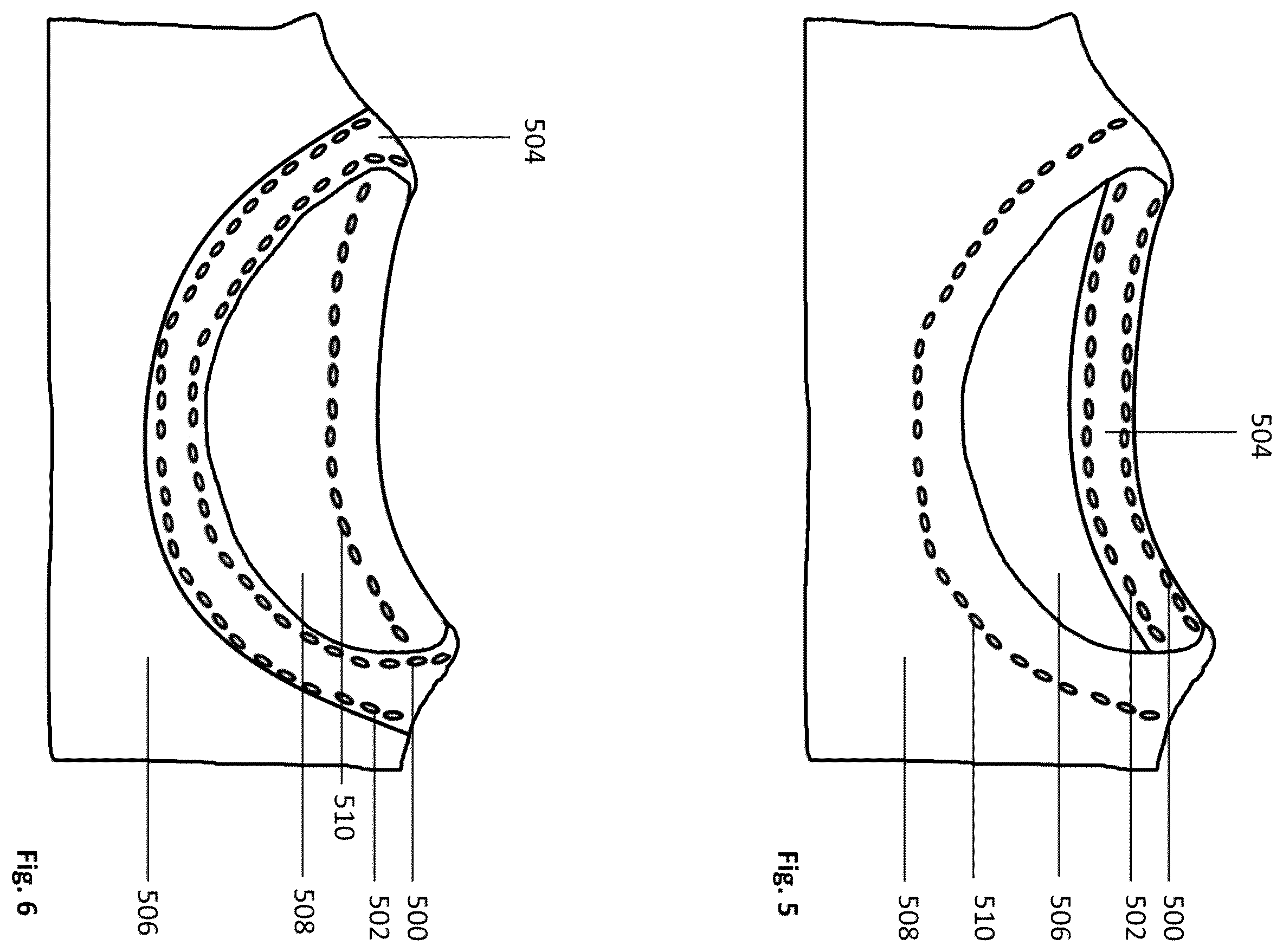 Patent US12376627 Figure 3 – Neckline fitting system