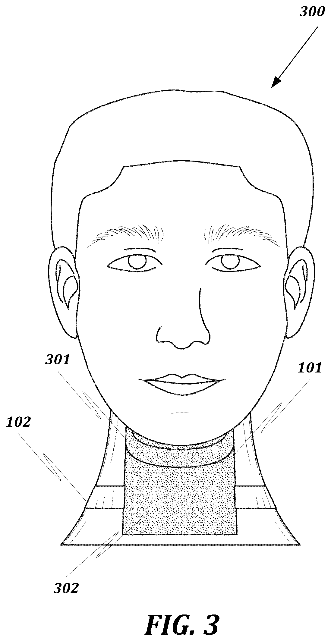 Patent US12376632 Figure 3 – Apparatus for restricting head movement
