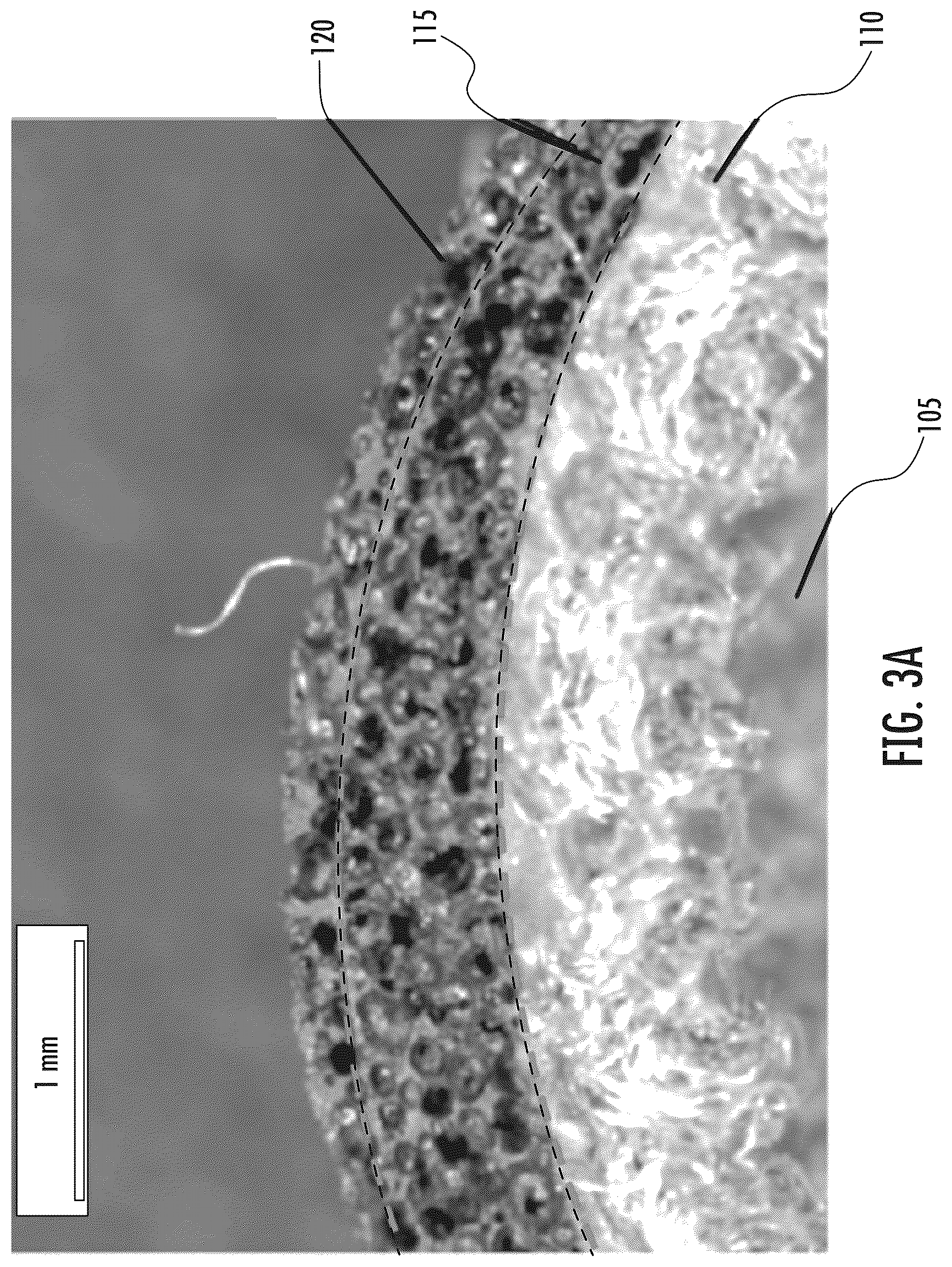 Patent US12376634 Figure 3 – Method for manufacturing multilayered coated fabric for personal protective equipment