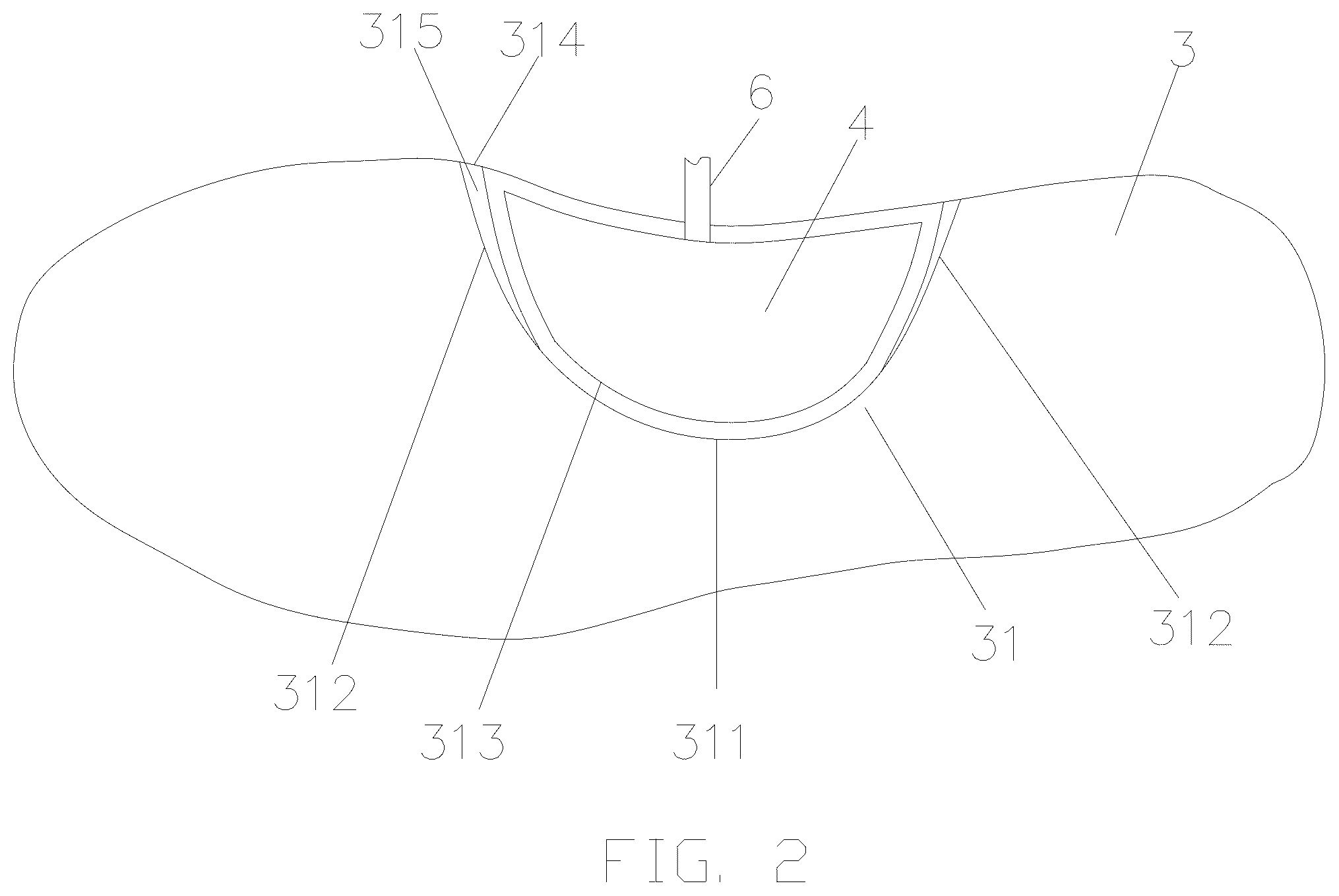Patent US12376641 Figure 2 – Sports shoe for flat foot prevention and correction