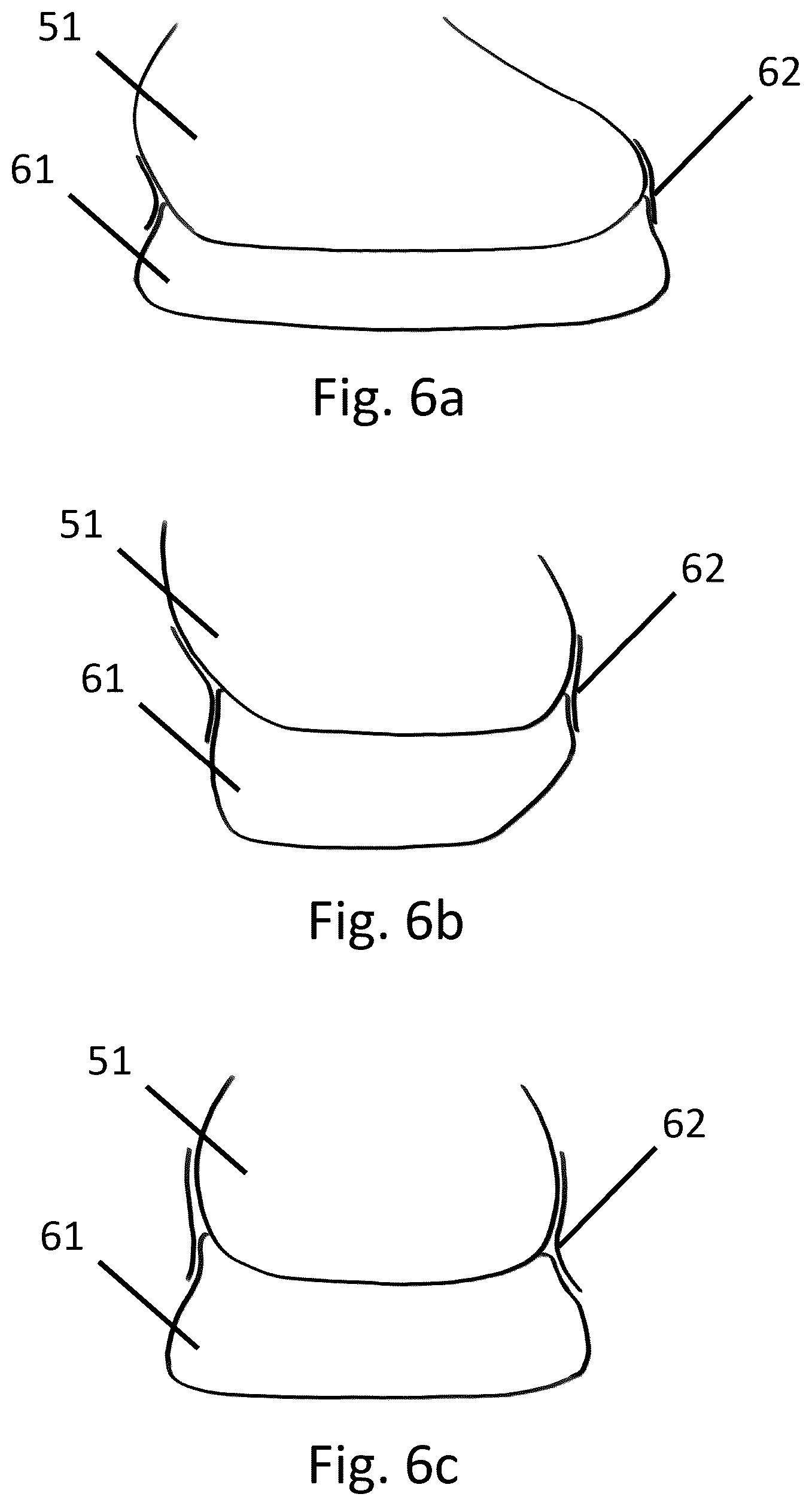 Patent US12376647 Figure 5 – Knitted shoe upper