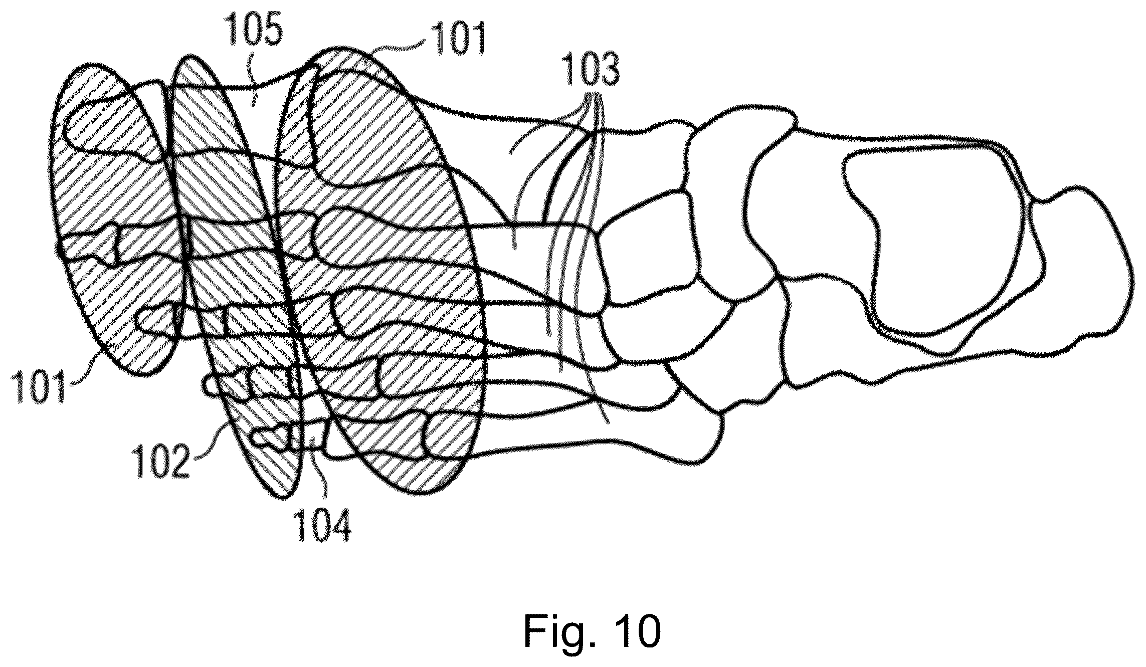 Patent US12376647 Figure 9 – Knitted shoe upper