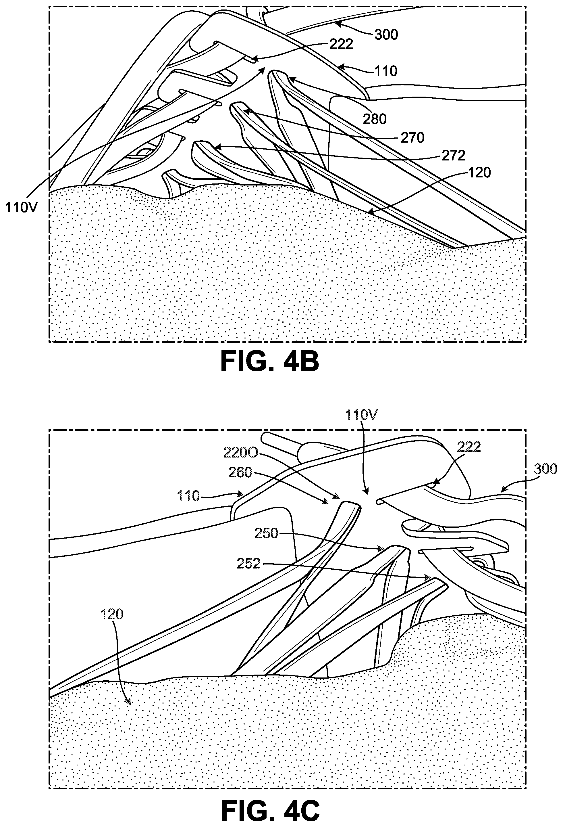 Patent US12376648 Figure 12 – Article of footwear including lace-engaging slots and foot wrapping bands