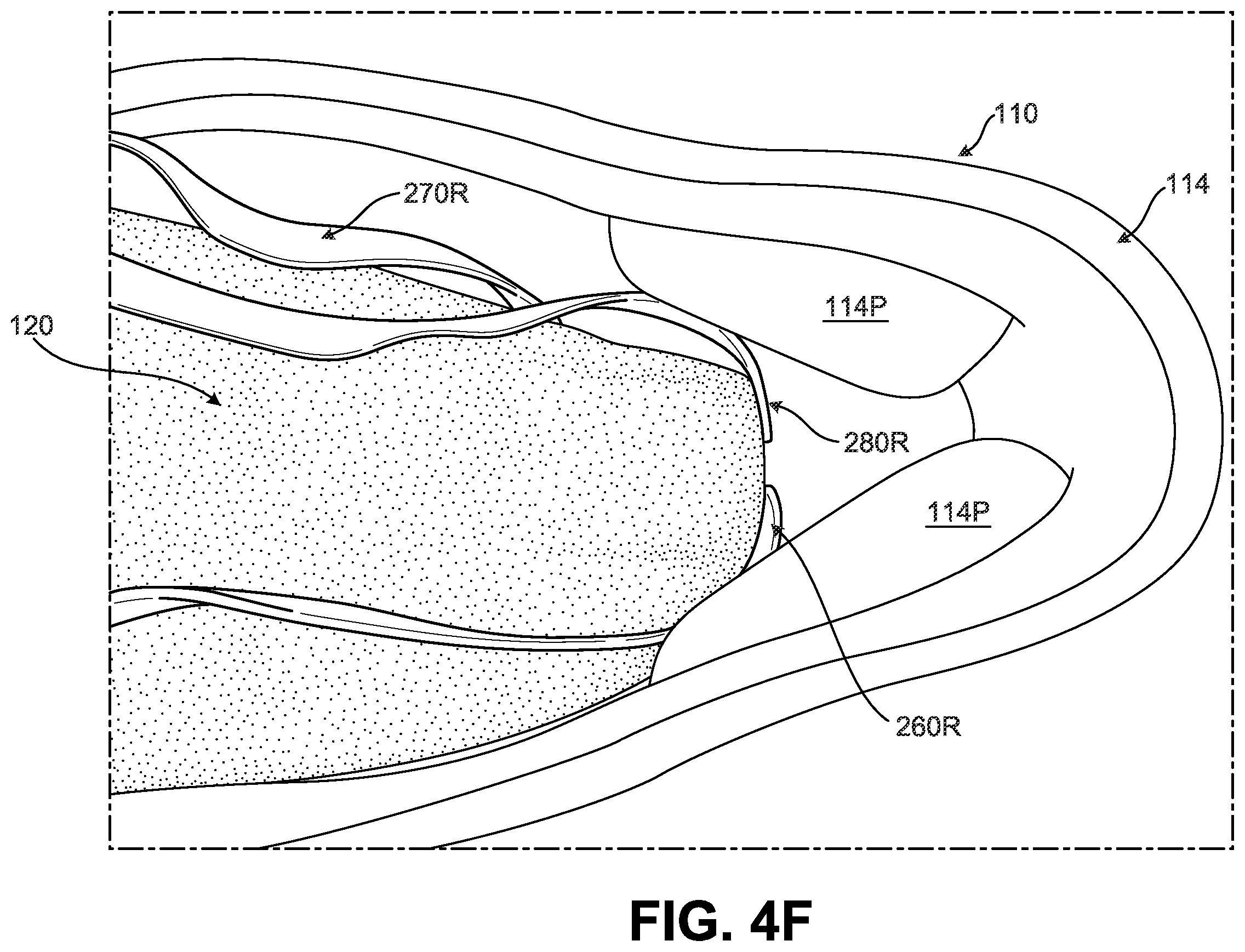 Patent US12376648 Figure 14 – Article of footwear including lace-engaging slots and foot wrapping bands