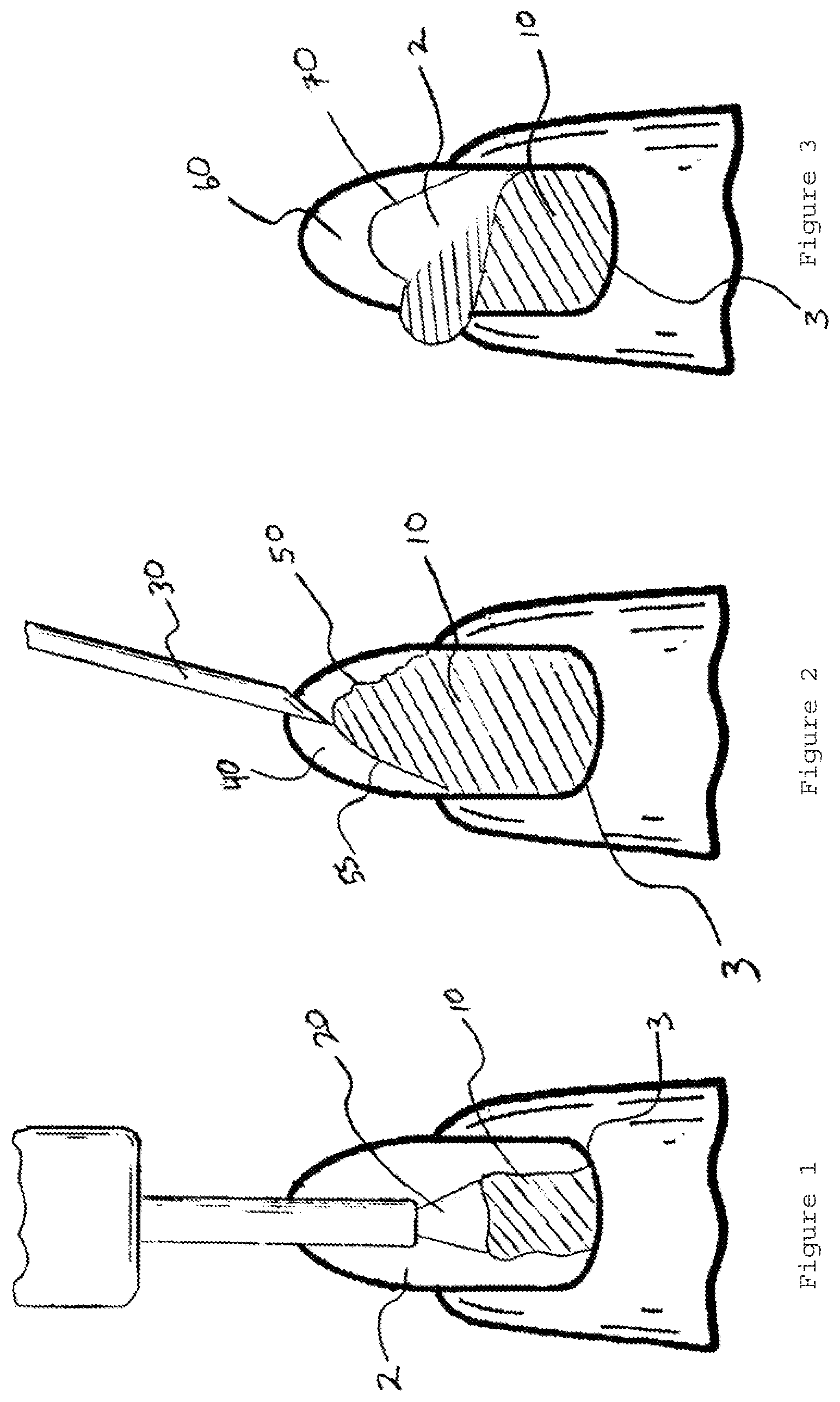 Patent US12376662 Figure 1 – Method for nail manicuring