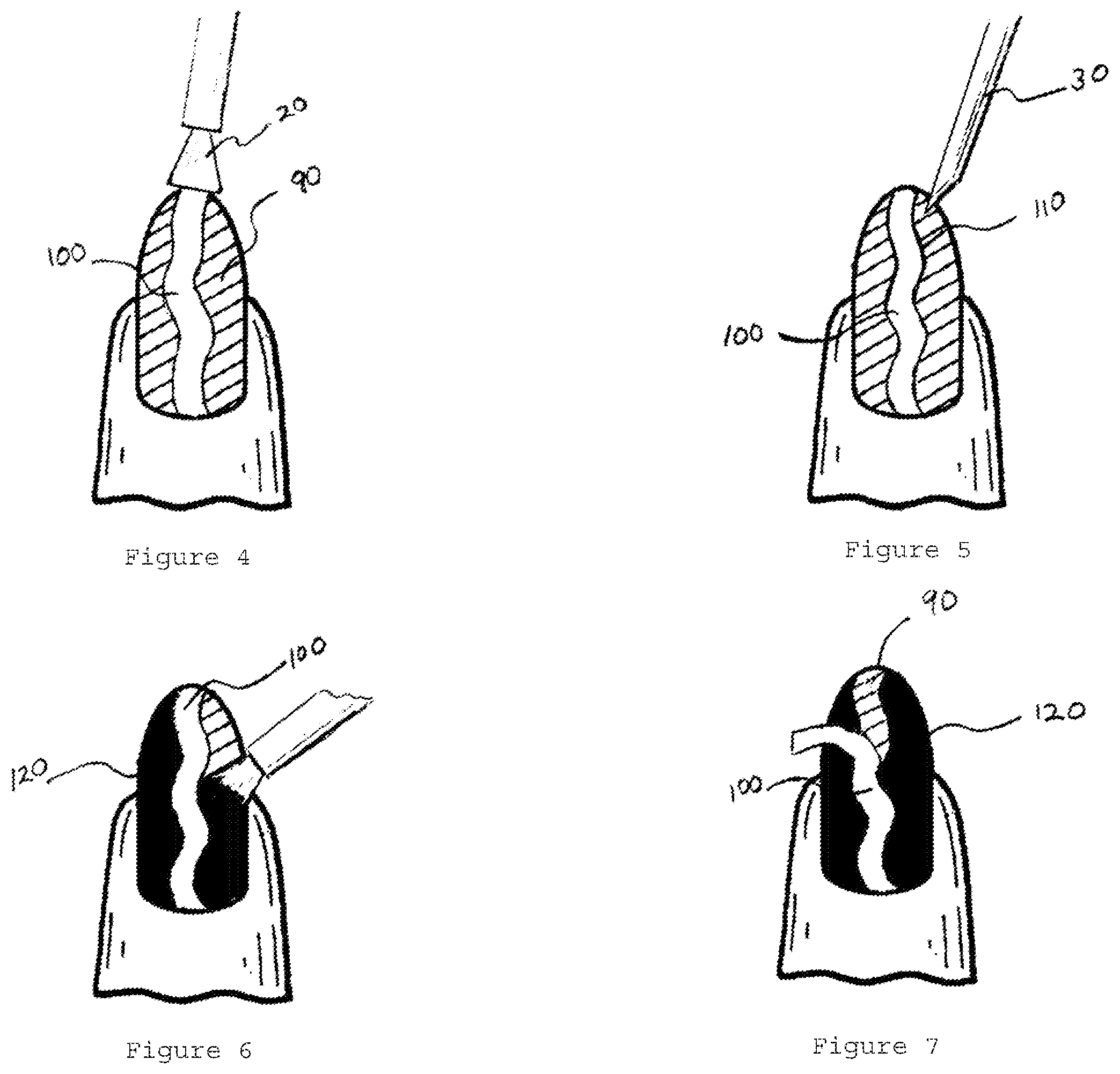 Patent US12376662 Figure 2 – Method for nail manicuring