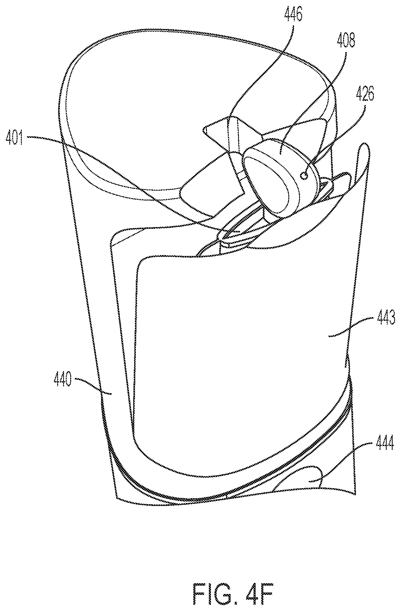 Patent US12376665 Figure 13 – Dermal spray apparatus with disposable cartrdige and method