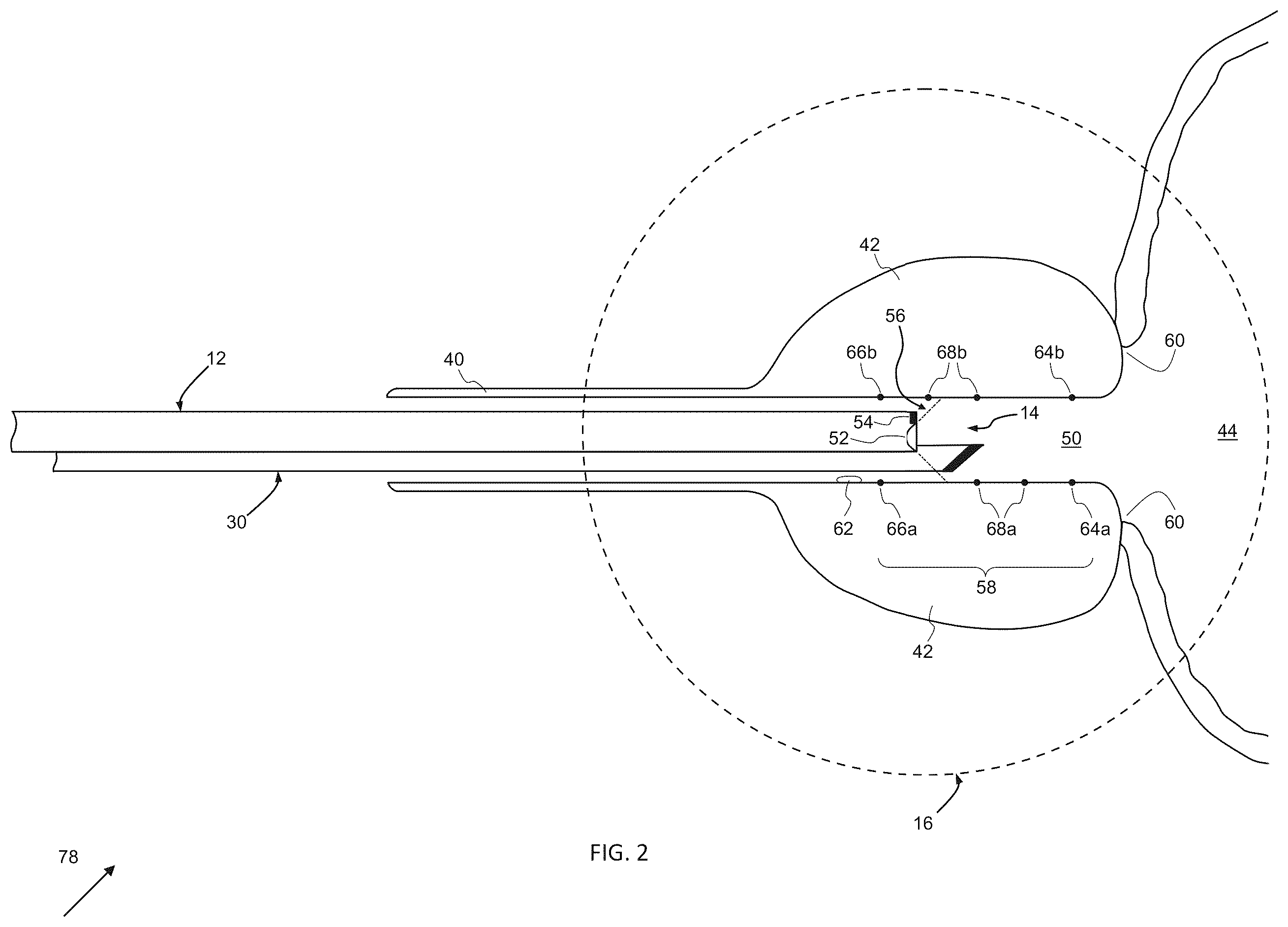 Patent US12376731 Figure 2 – Systems, apparatuses, and methods for endoscopy