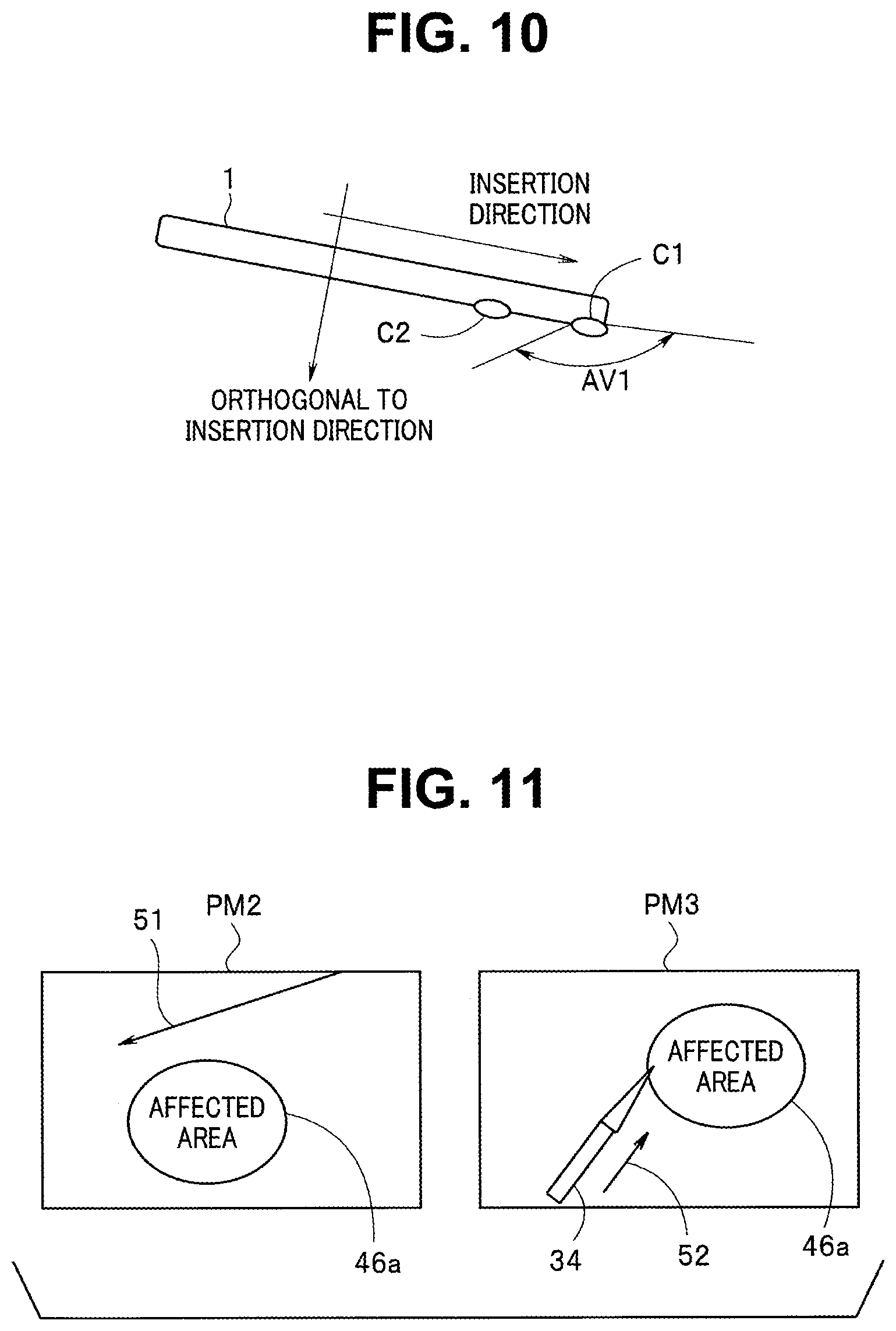 Patent US12376732 Figure 9 – Display control apparatus, display control method, and non-transitory recording medium on which display control program is recorded