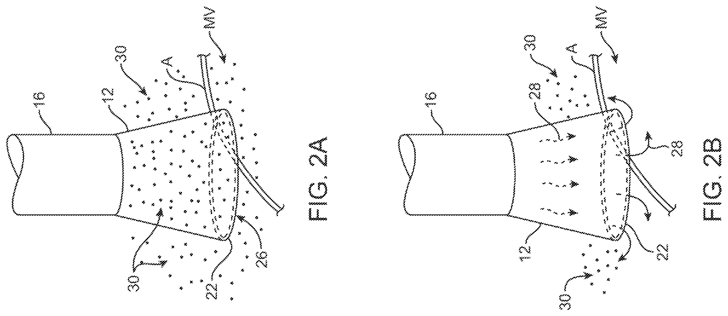 Patent US12376735 Figure 2 – In-vivo visualization systems