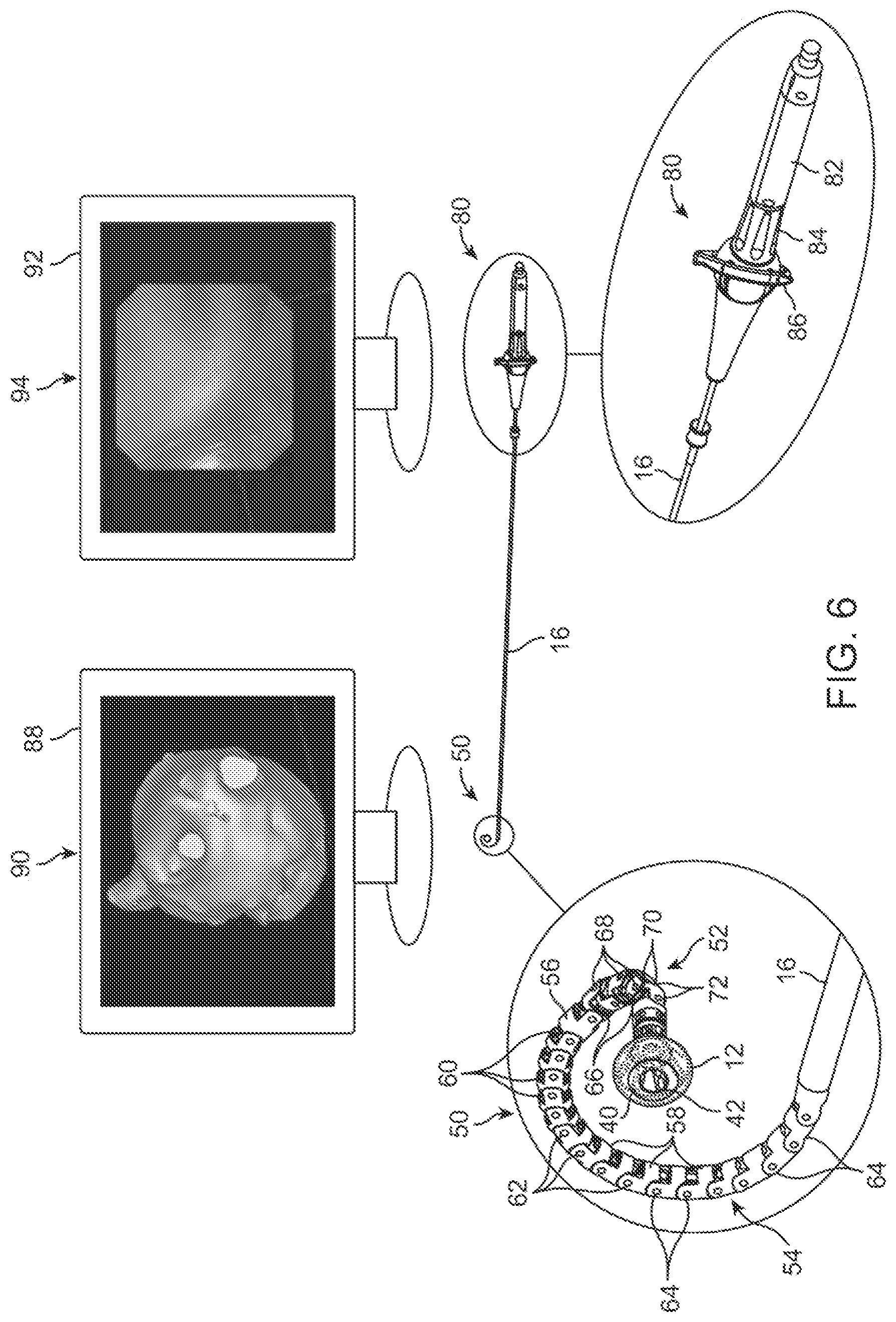 Patent US12376735 Figure 6 – In-vivo visualization systems