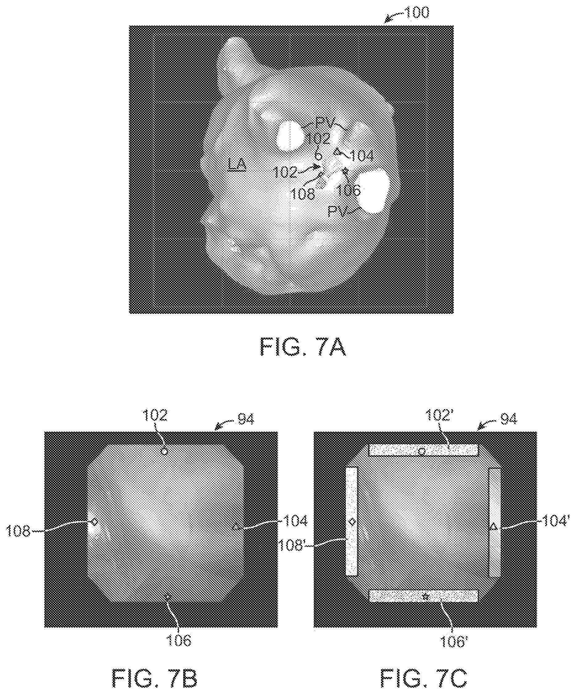 Patent US12376735 Figure 7 – In-vivo visualization systems
