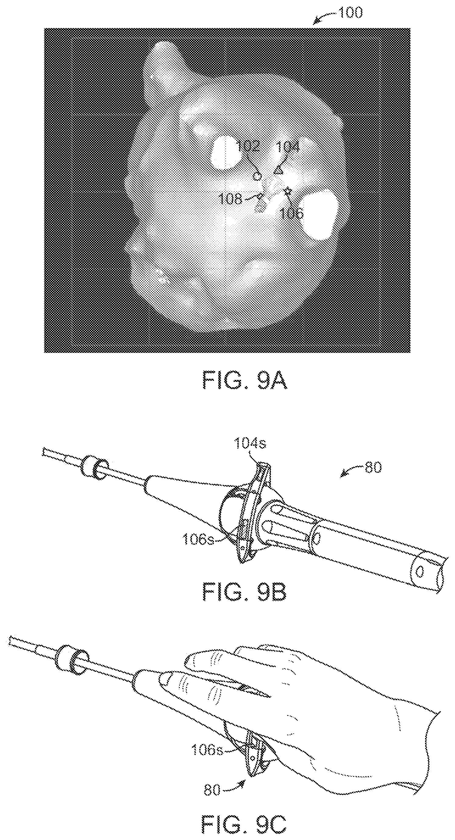 Patent US12376735 Figure 9 – In-vivo visualization systems