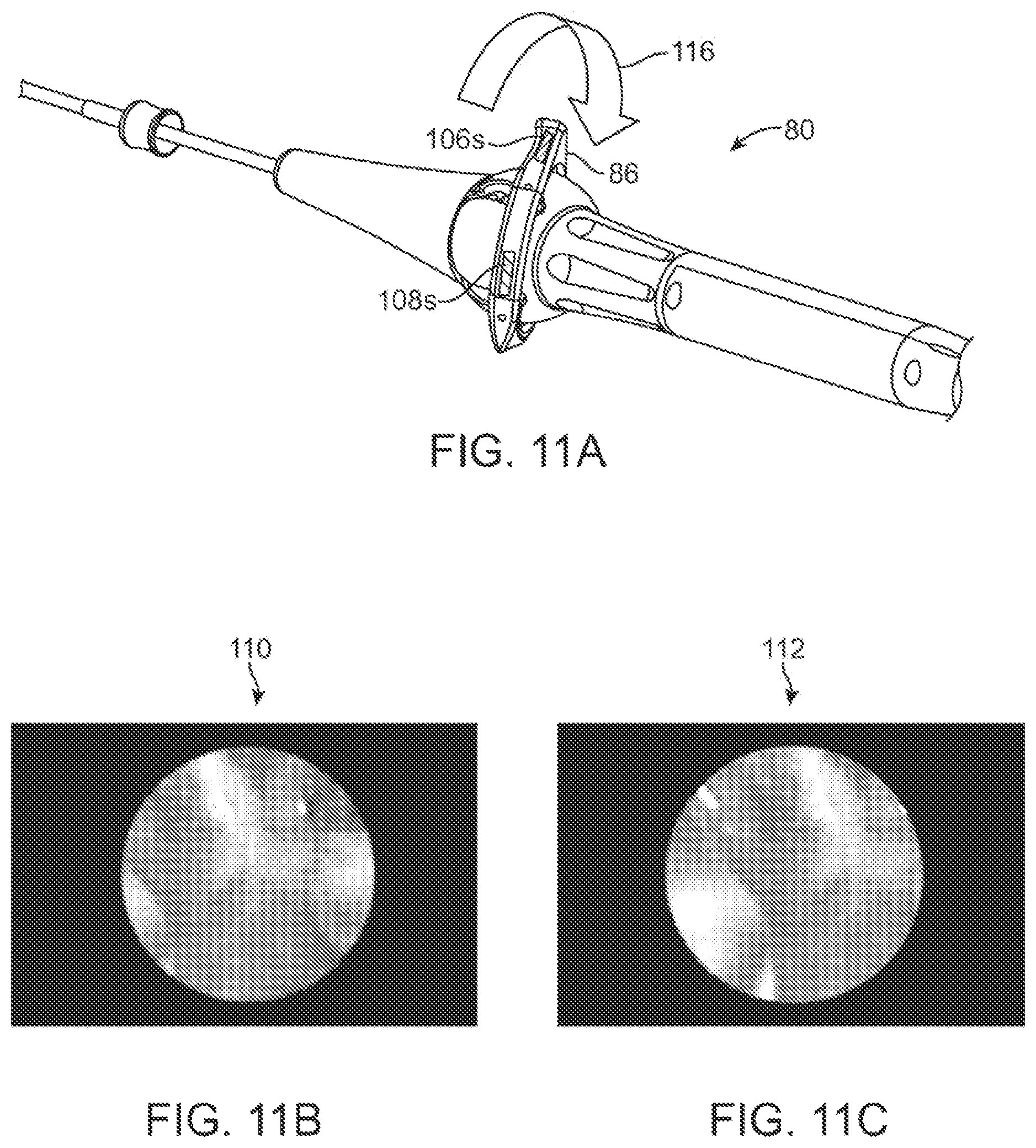 Patent US12376735 Figure 11 – In-vivo visualization systems