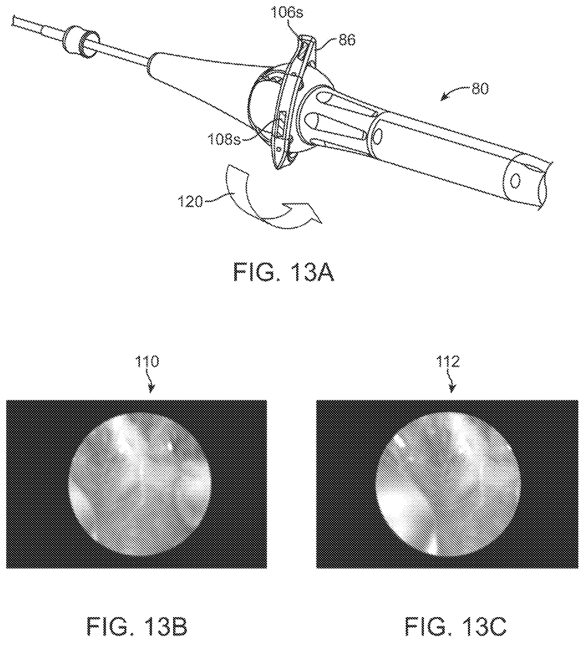 Patent US12376735 Figure 13 – In-vivo visualization systems