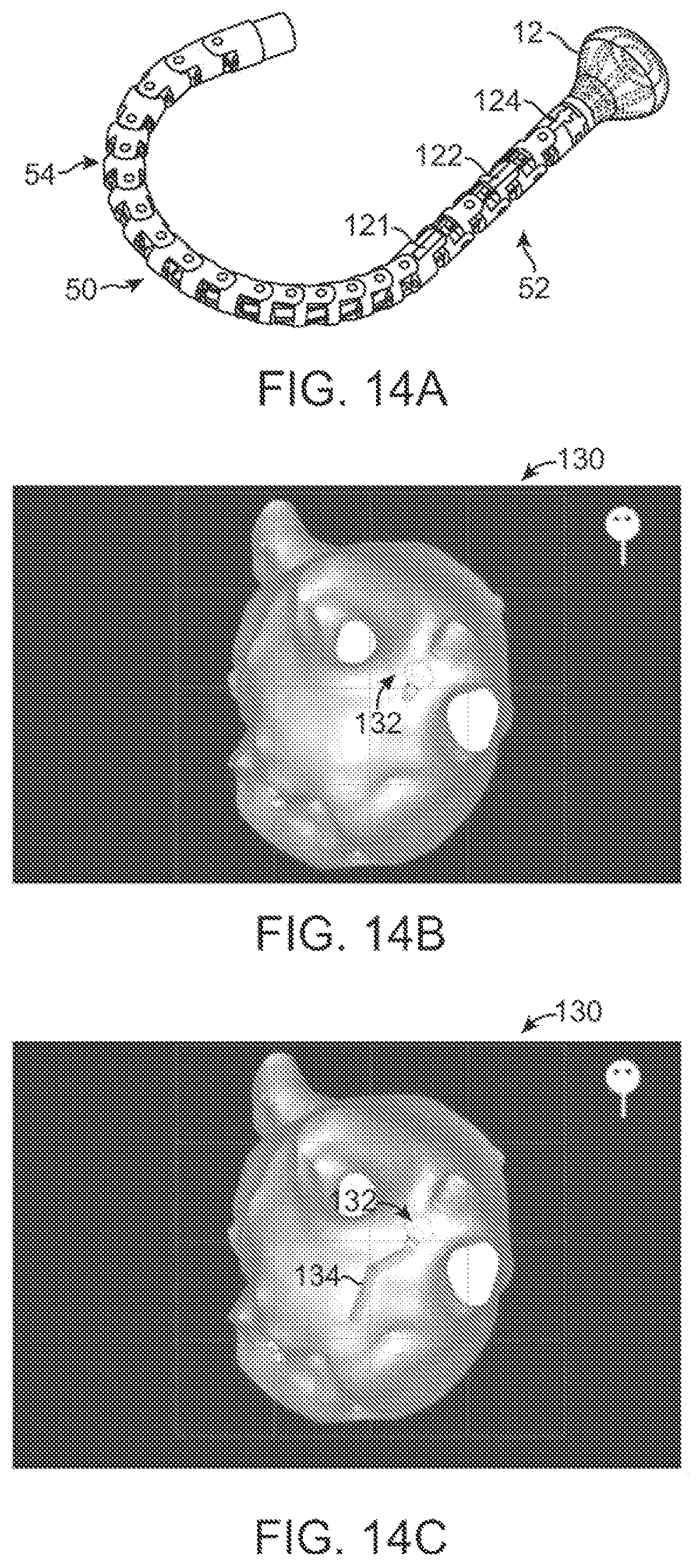 Patent US12376735 Figure 14 – In-vivo visualization systems