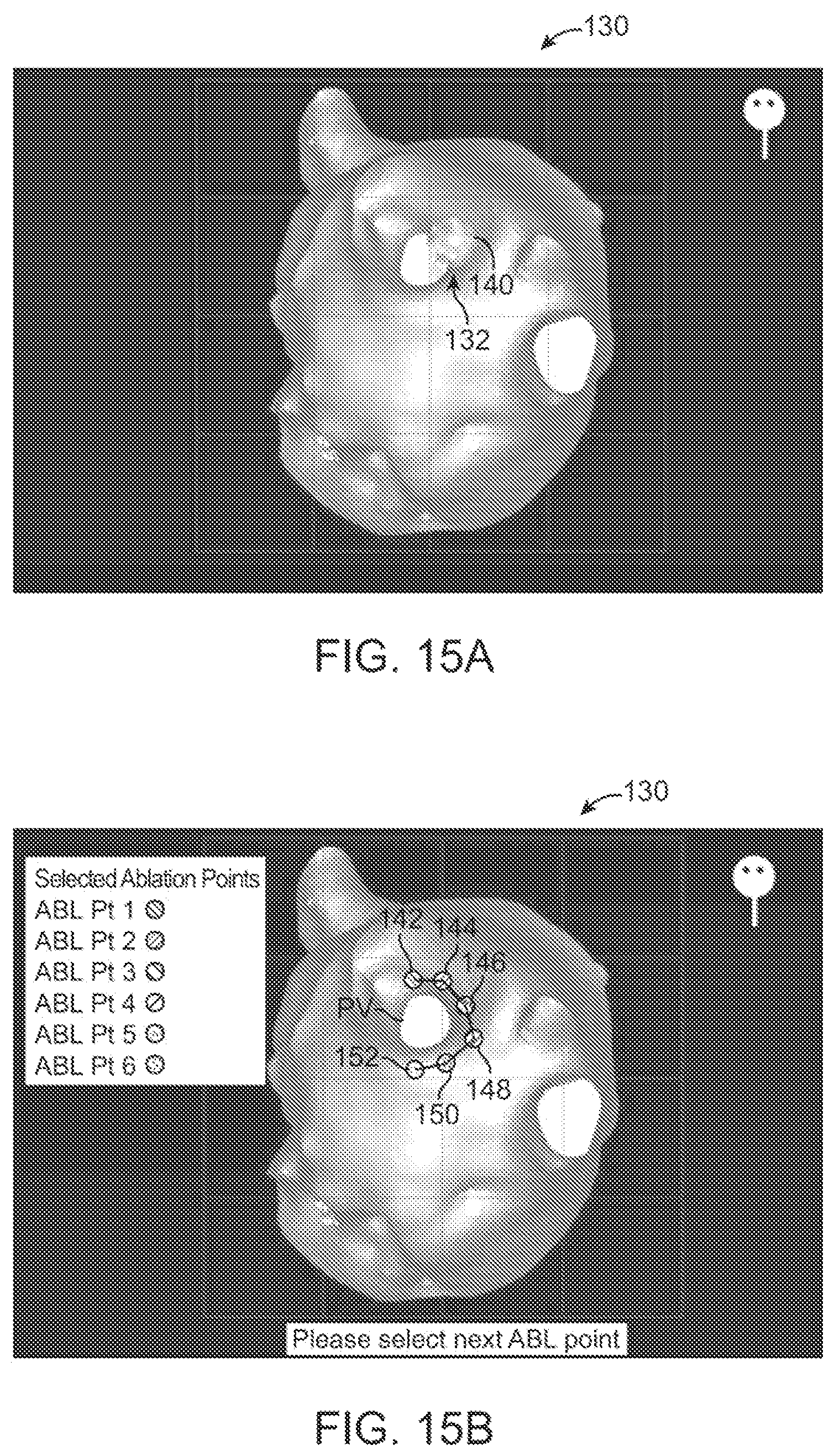 Patent US12376735 Figure 15 – In-vivo visualization systems