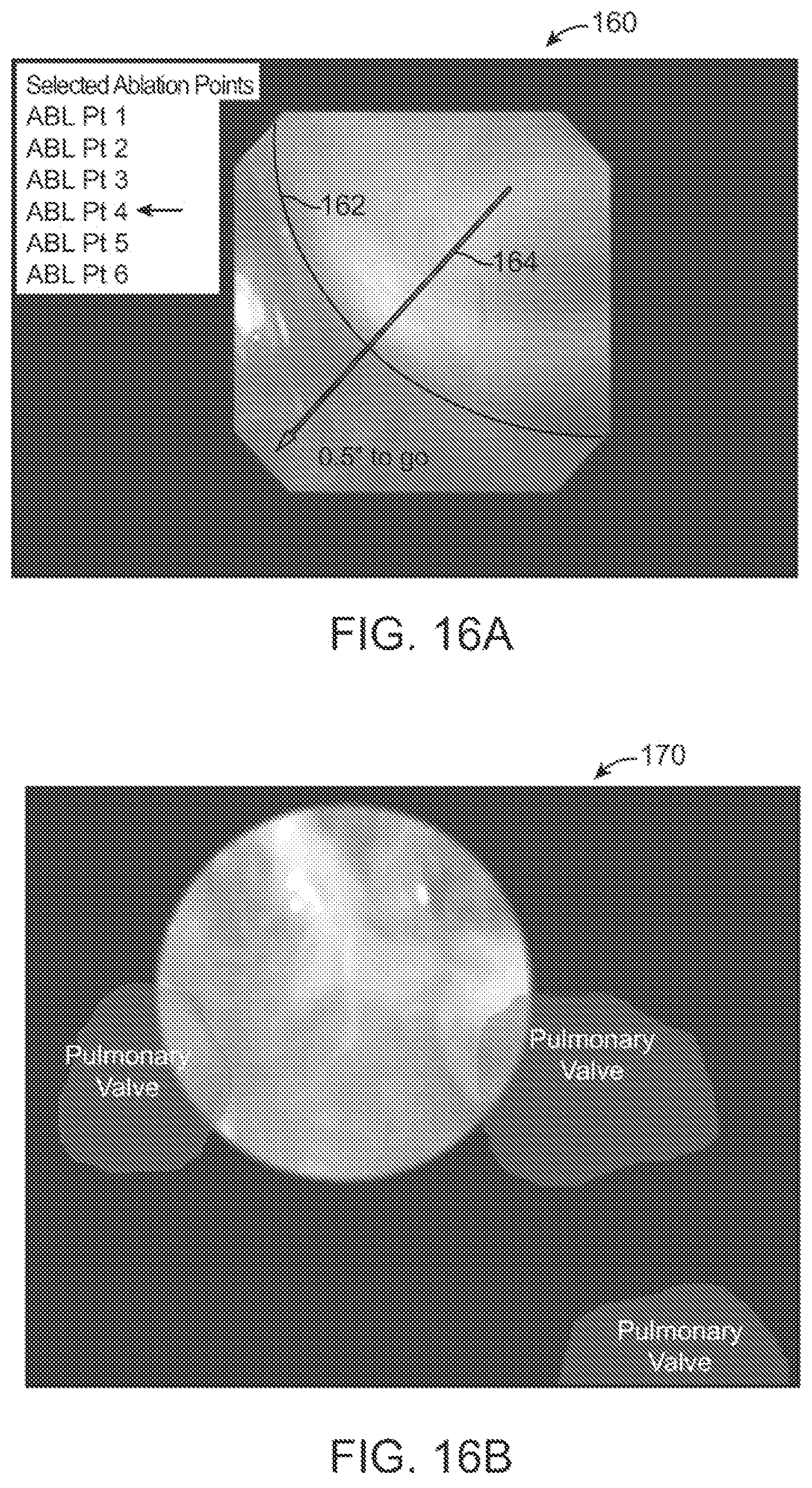 Patent US12376735 Figure 16 – In-vivo visualization systems