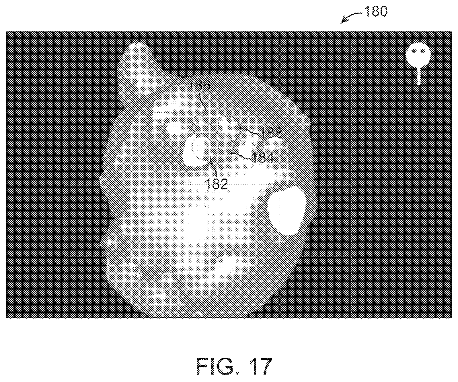 Patent US12376735 Figure 17 – In-vivo visualization systems