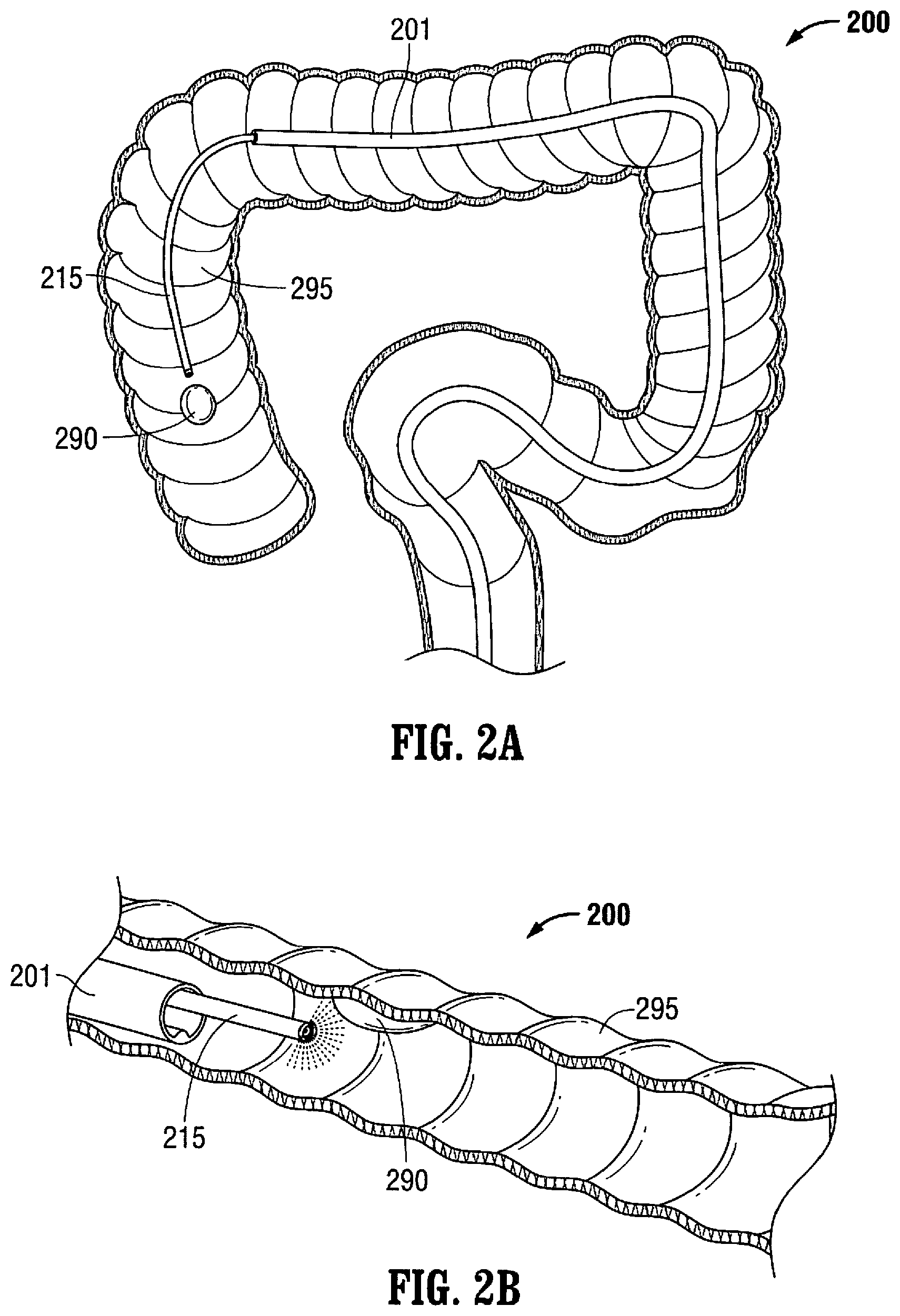 Patent US12376737 Figure 2 – Tissue retractor for minimally invasive surgery