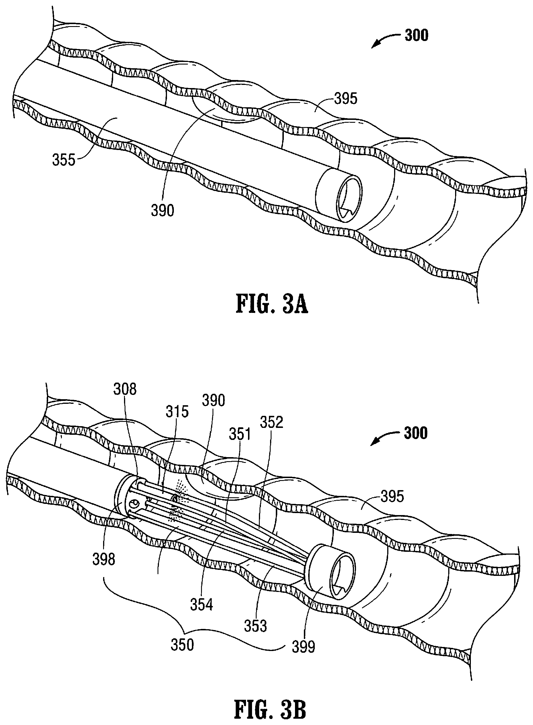 Patent US12376737 Figure 3 – Tissue retractor for minimally invasive surgery