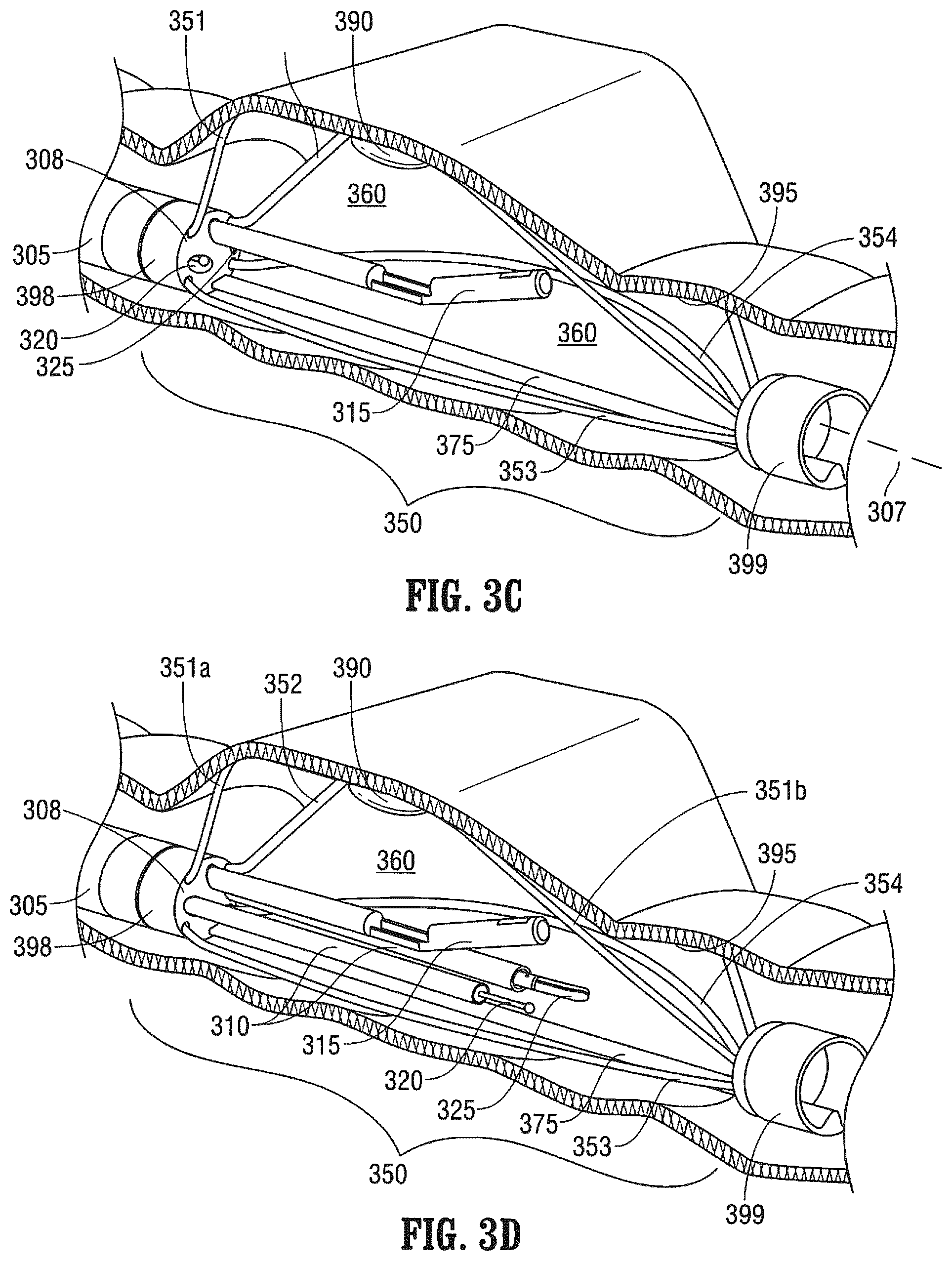 Patent US12376737 Figure 4 – Tissue retractor for minimally invasive surgery
