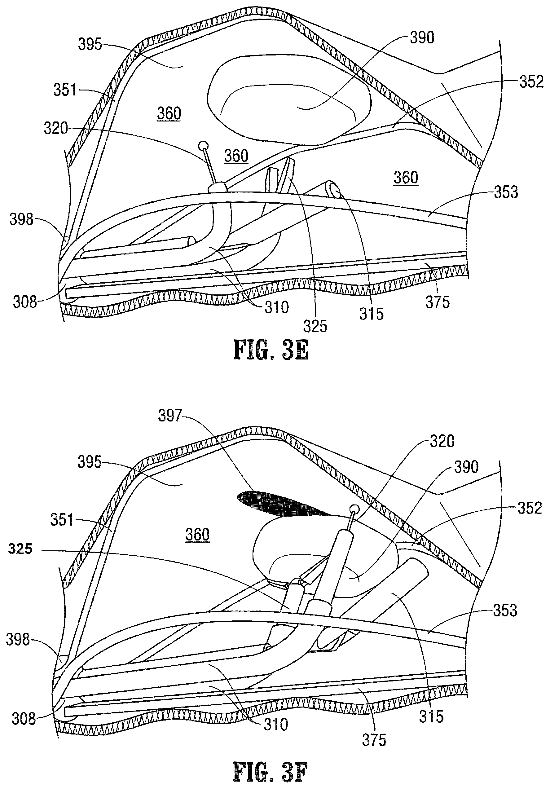 Patent US12376737 Figure 5 – Tissue retractor for minimally invasive surgery