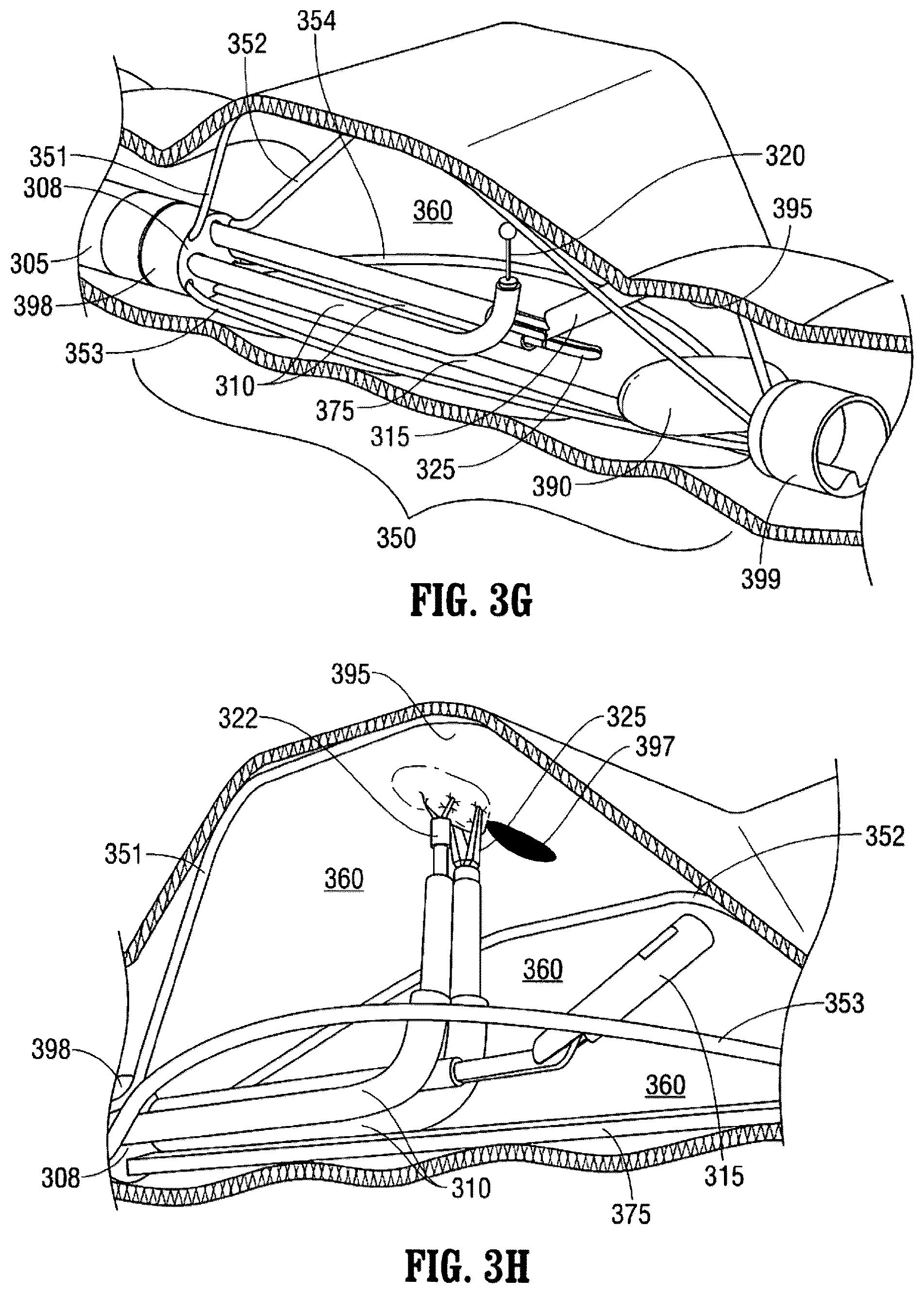 Patent US12376737 Figure 6 – Tissue retractor for minimally invasive surgery