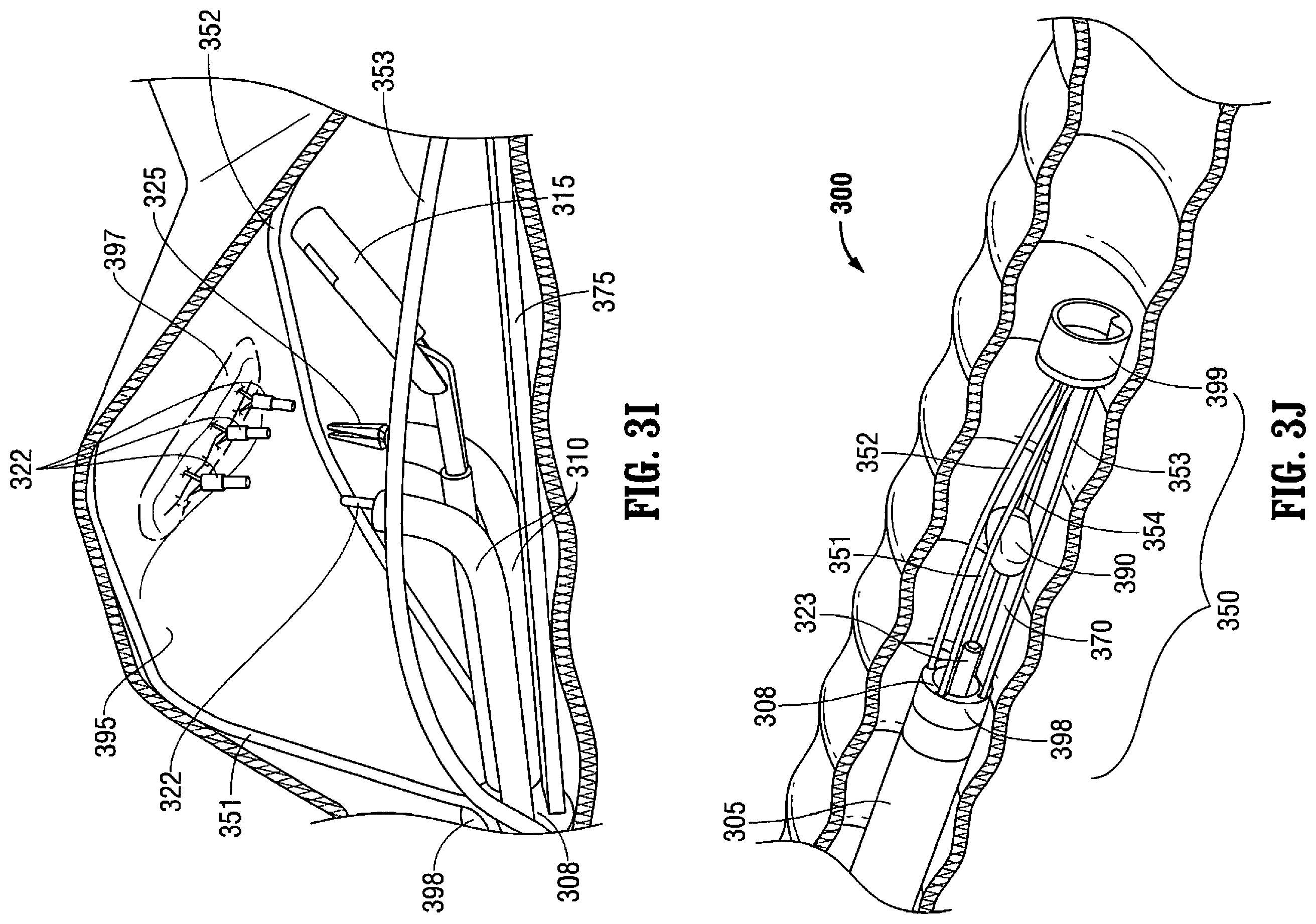 Patent US12376737 Figure 7 – Tissue retractor for minimally invasive surgery