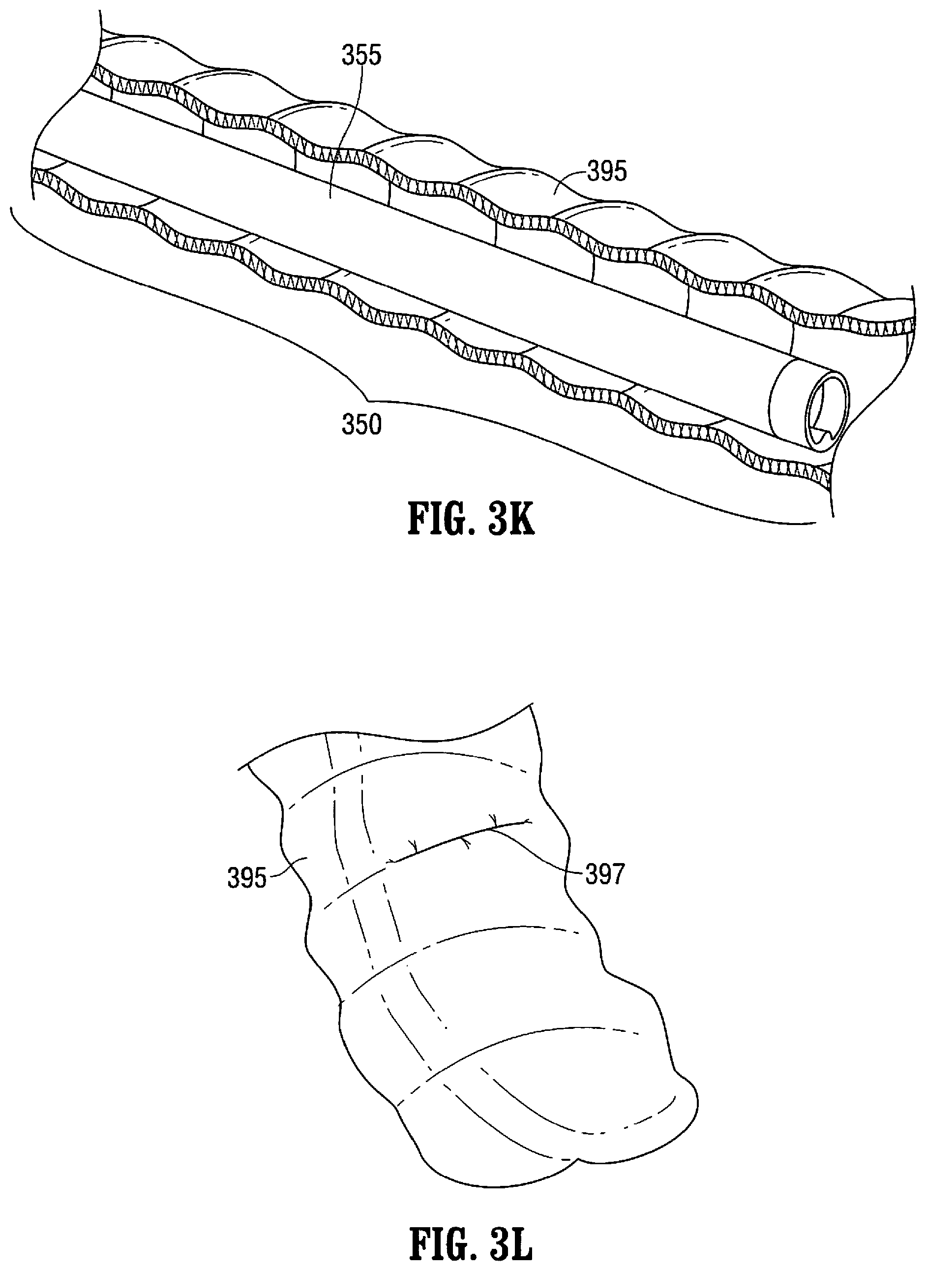 Patent US12376737 Figure 8 – Tissue retractor for minimally invasive surgery