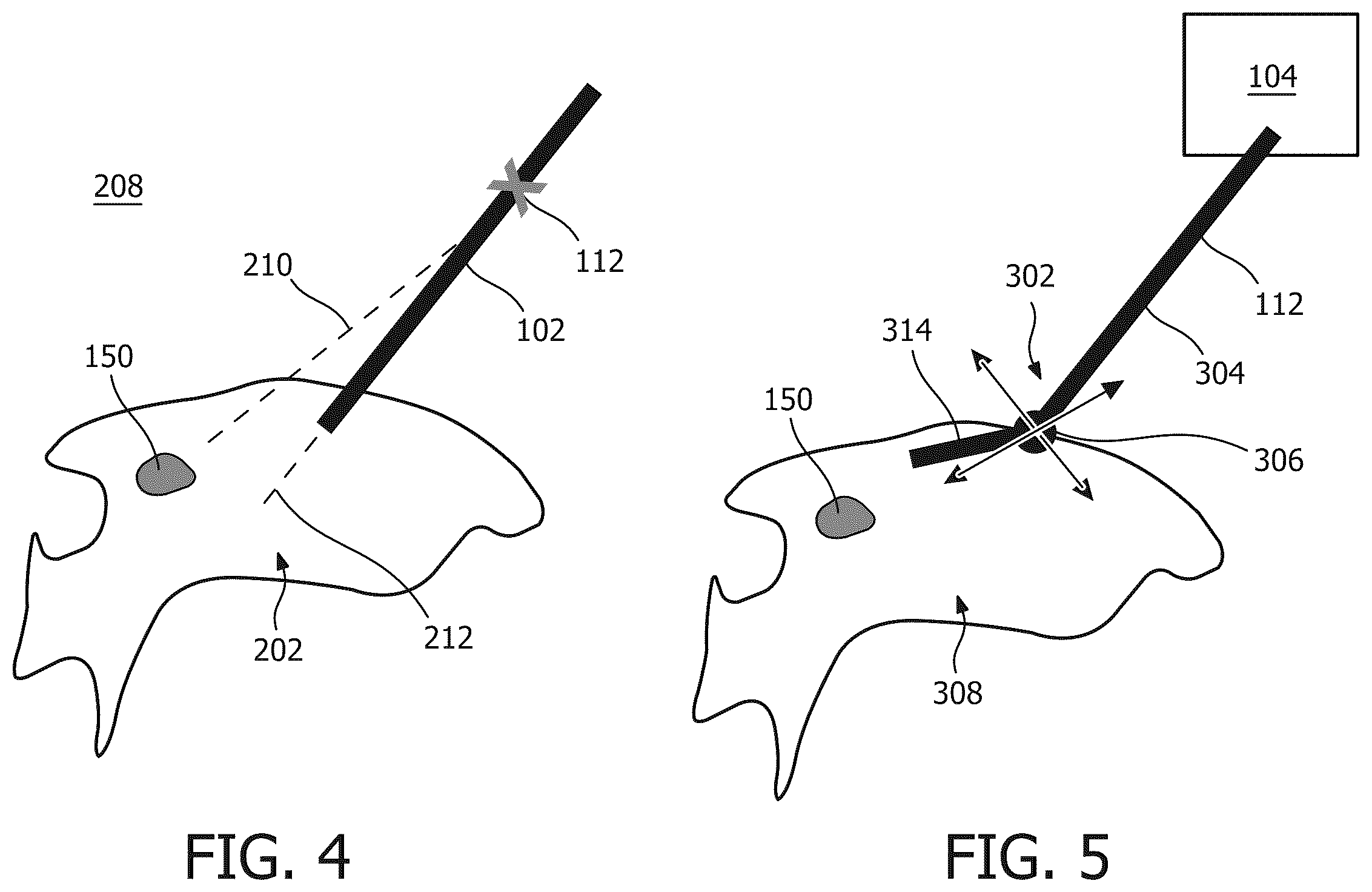 Patent US12376738 Figure 3 – Image guided robotic system for tumor aspiration