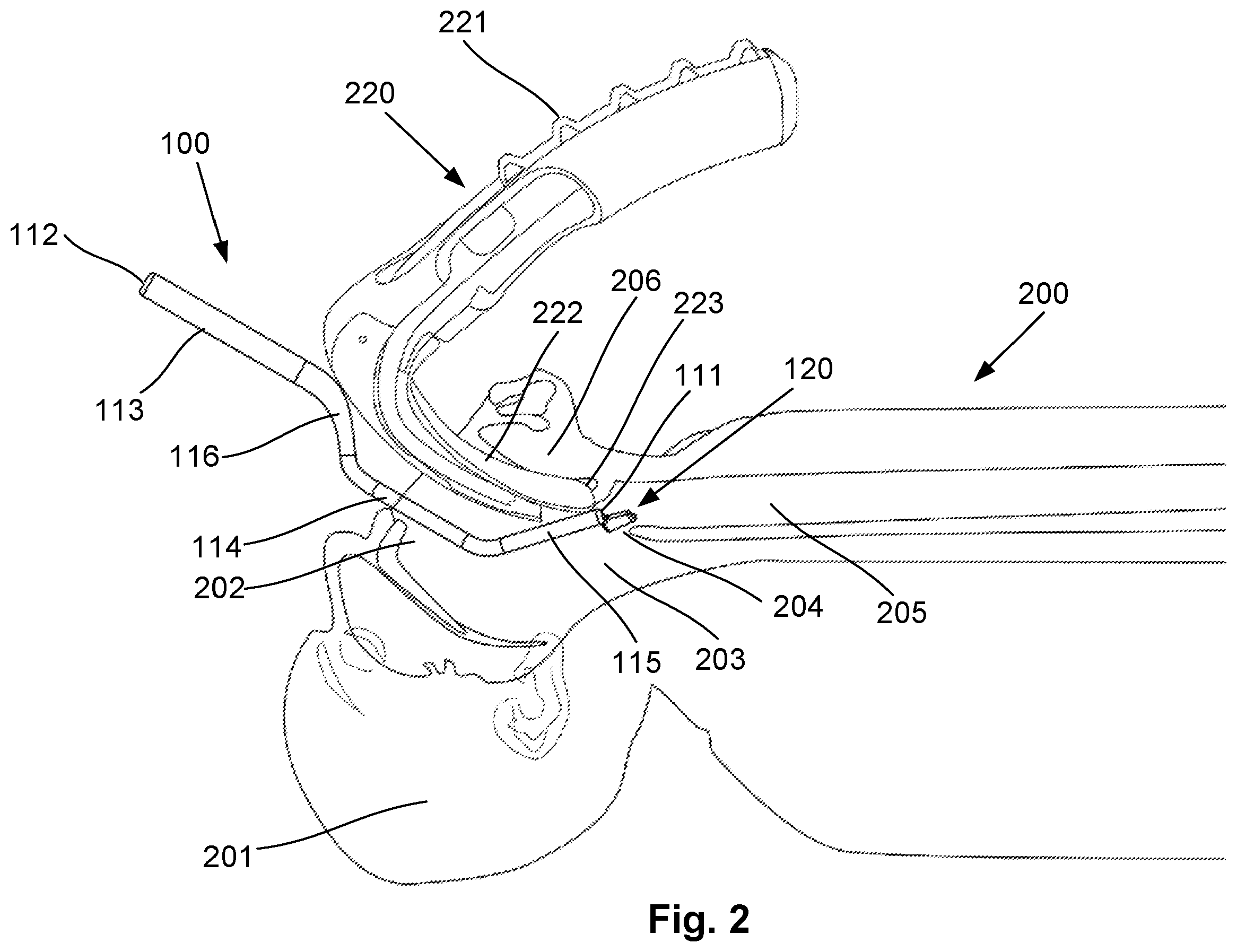 Patent US12376740 Figure 3 – Airway manipulator devices