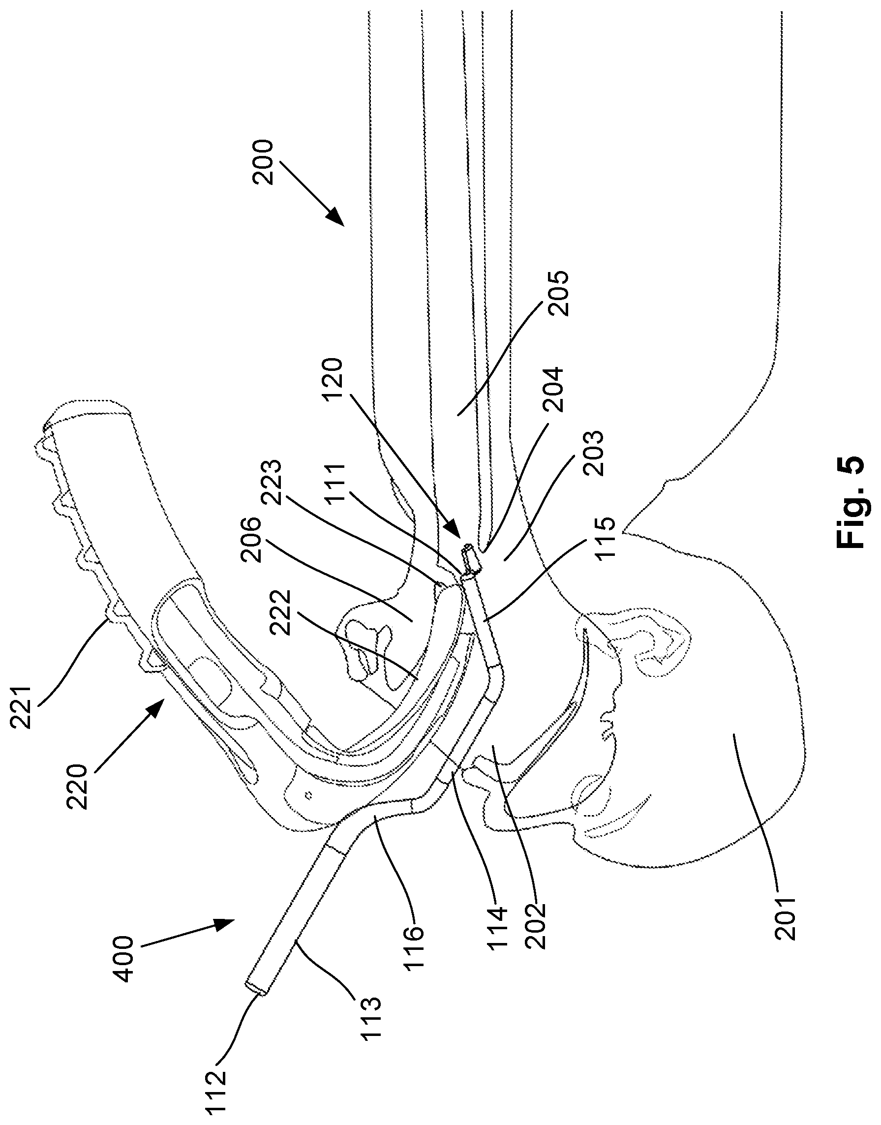 Patent US12376740 Figure 7 – Airway manipulator devices