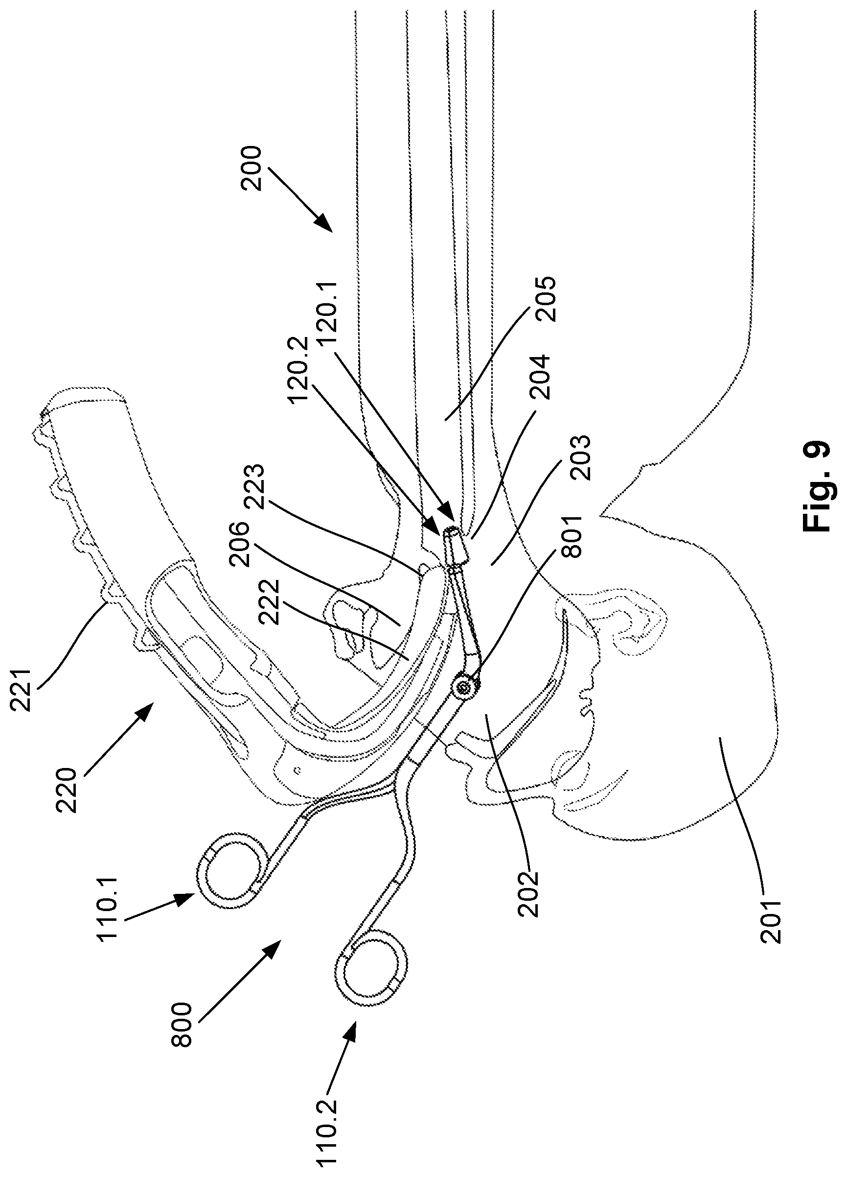Patent US12376740 Figure 14 – Airway manipulator devices