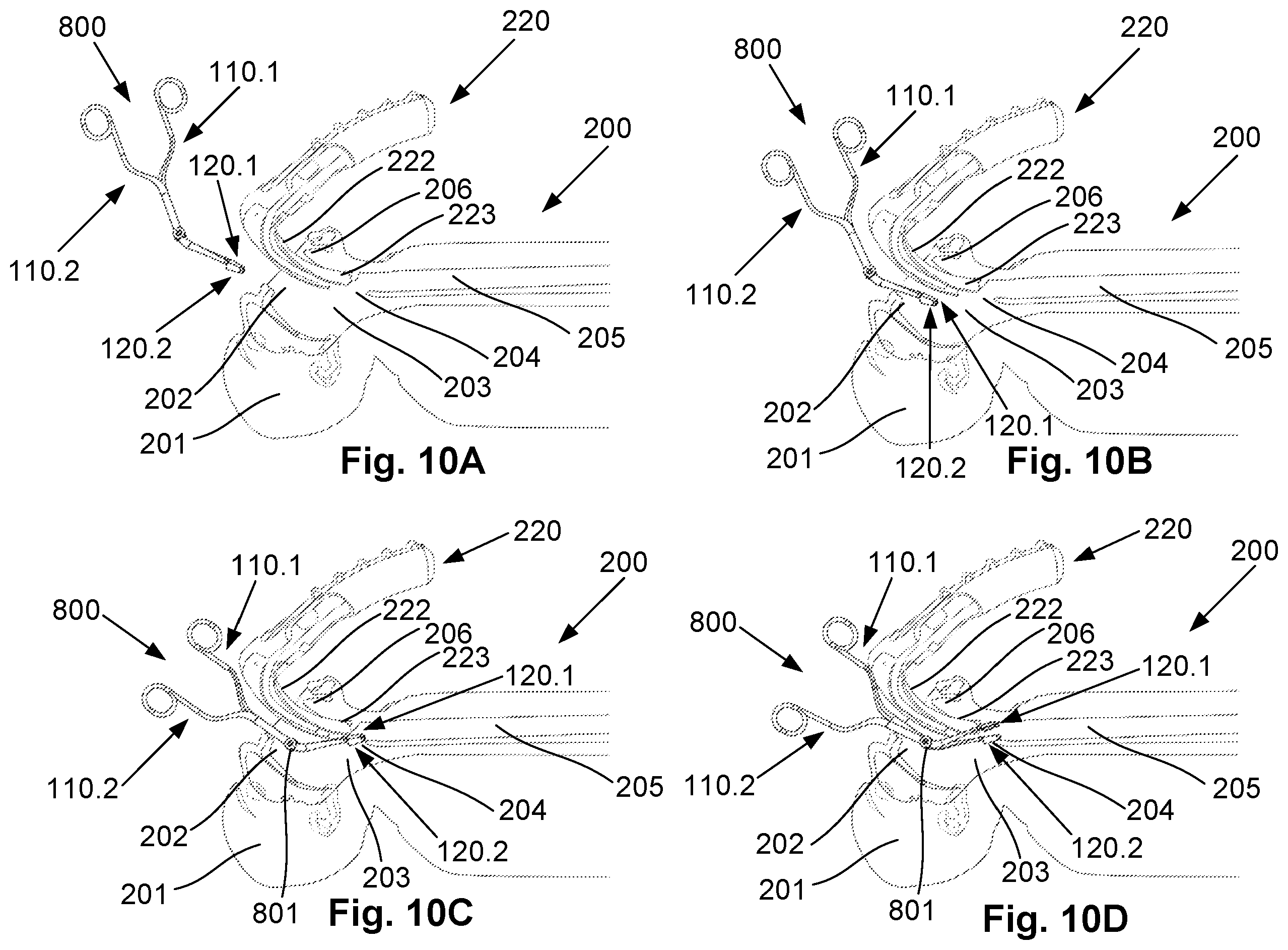 Patent US12376740 Figure 15 – Airway manipulator devices