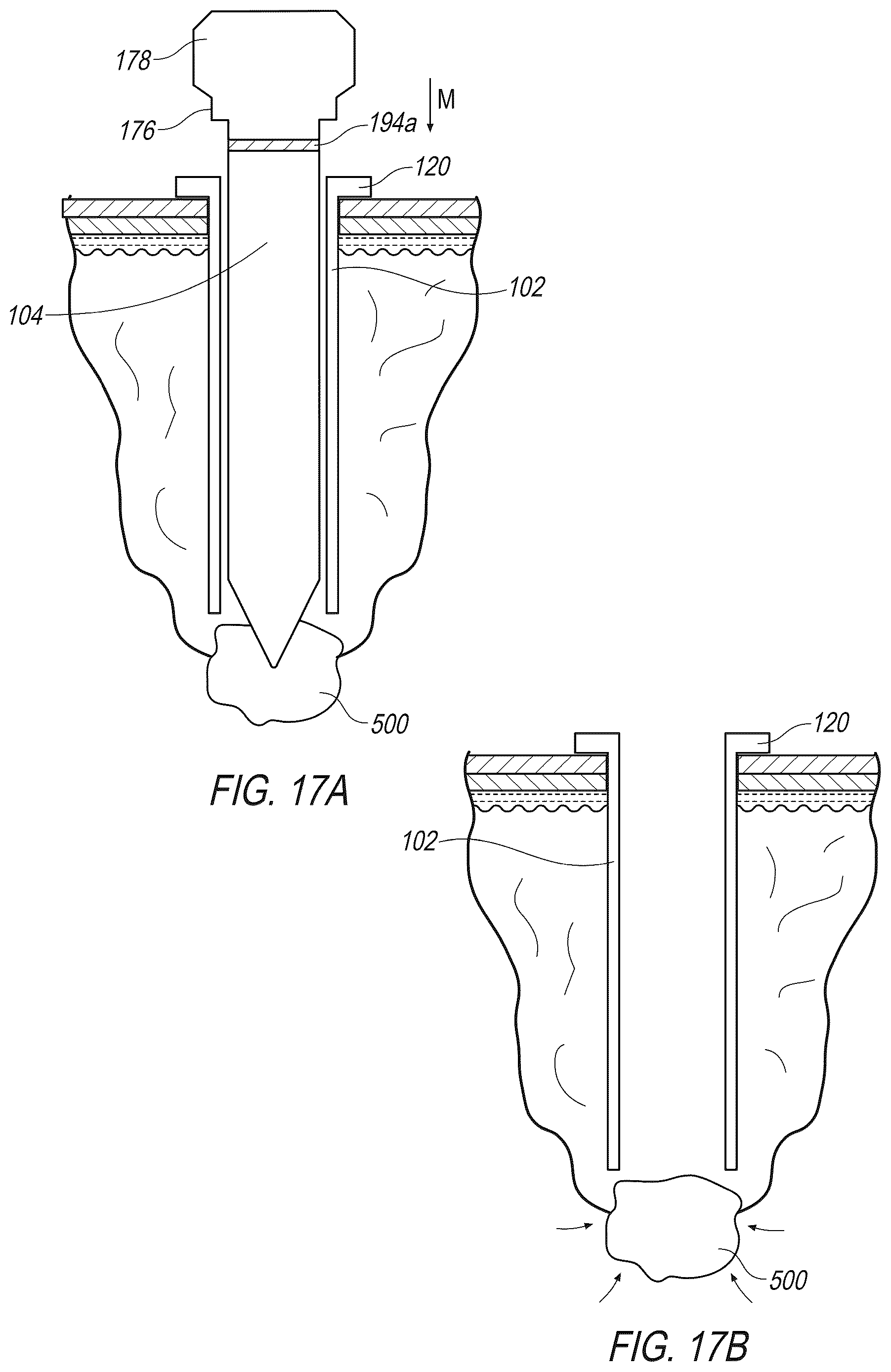Patent US12376741 Figure 20 – Surgical access assembly and method of using same