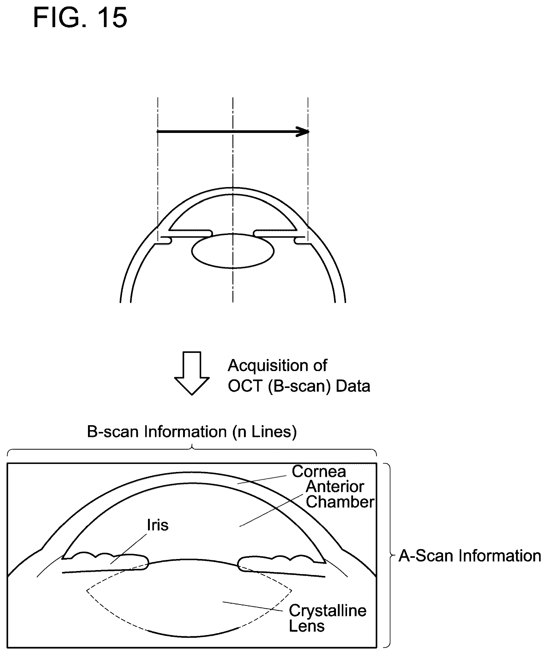 Patent US12376743 Figure 15 – Ophthalmic device