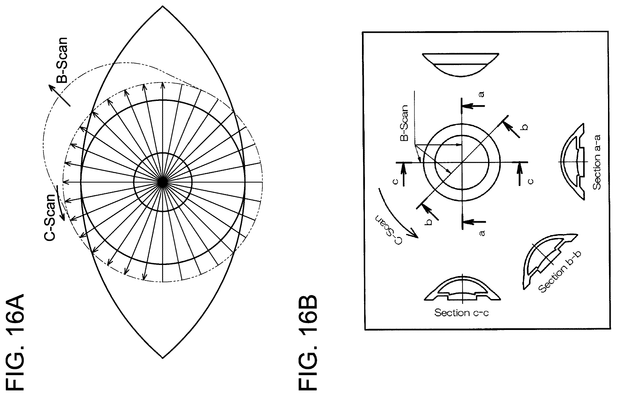 Patent US12376743 Figure 16 – Ophthalmic device